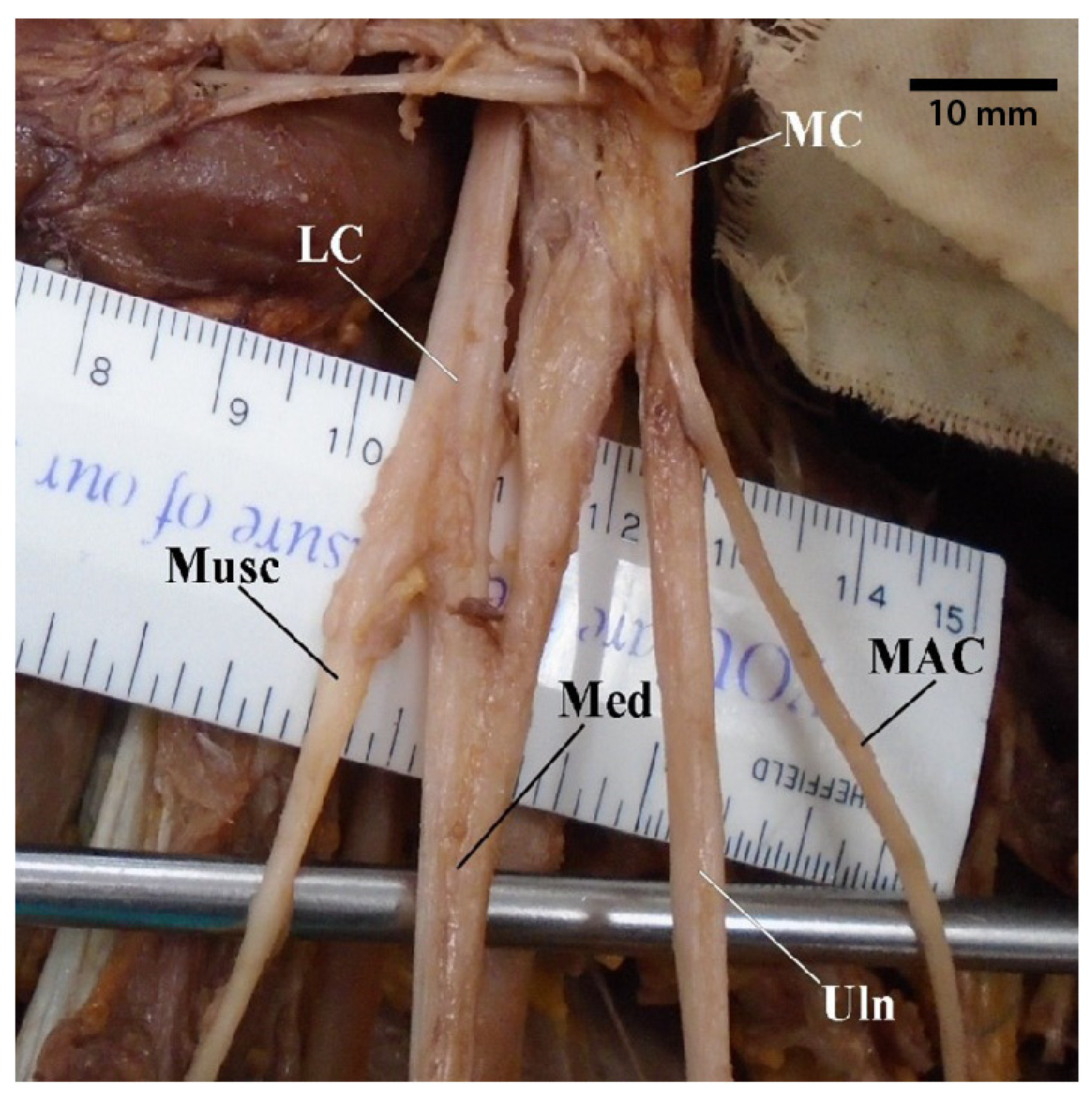 Diagnostics 13 00830 g002 Diagnostics 13 00830 g002