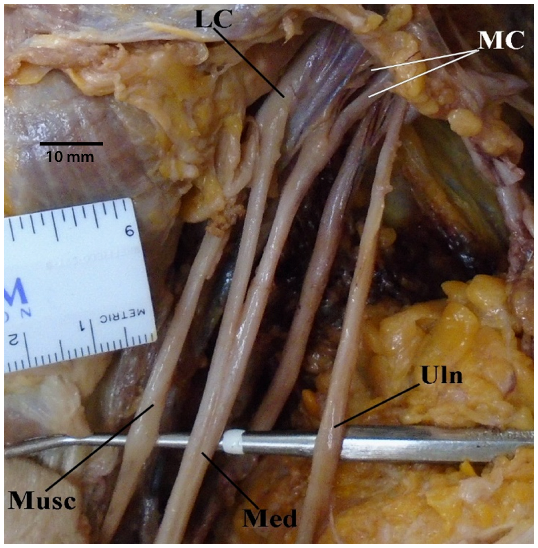 Diagnostics 13 00830 g003 Diagnostics 13 00830 g003