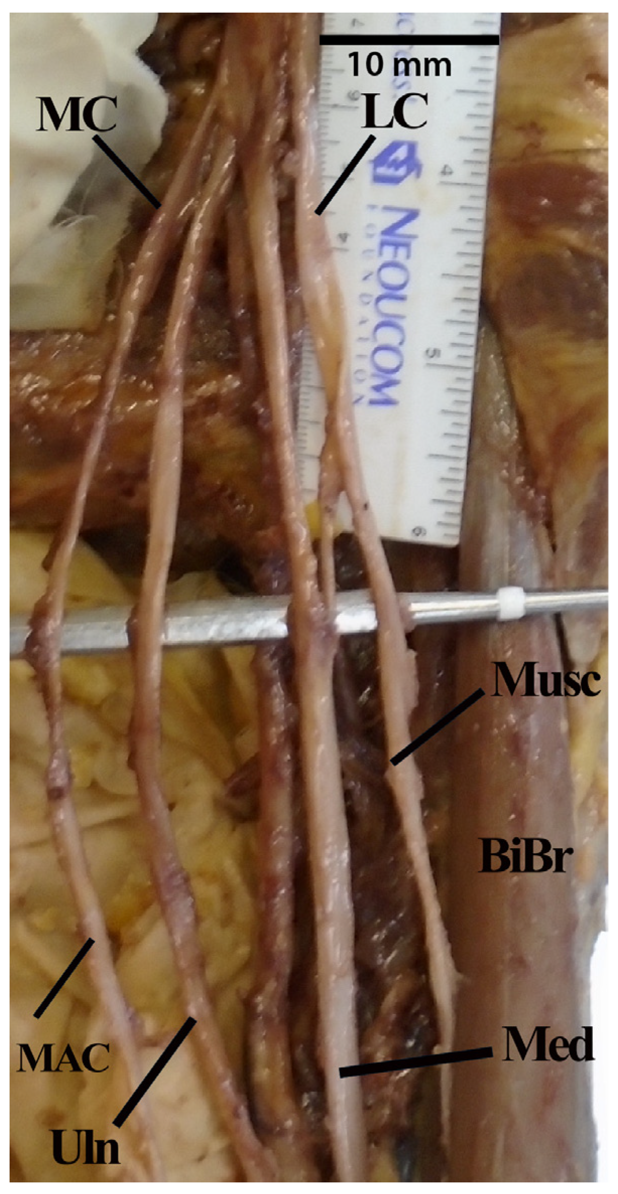 Diagnostics 13 00830 g004 Diagnostics 13 00830 g004