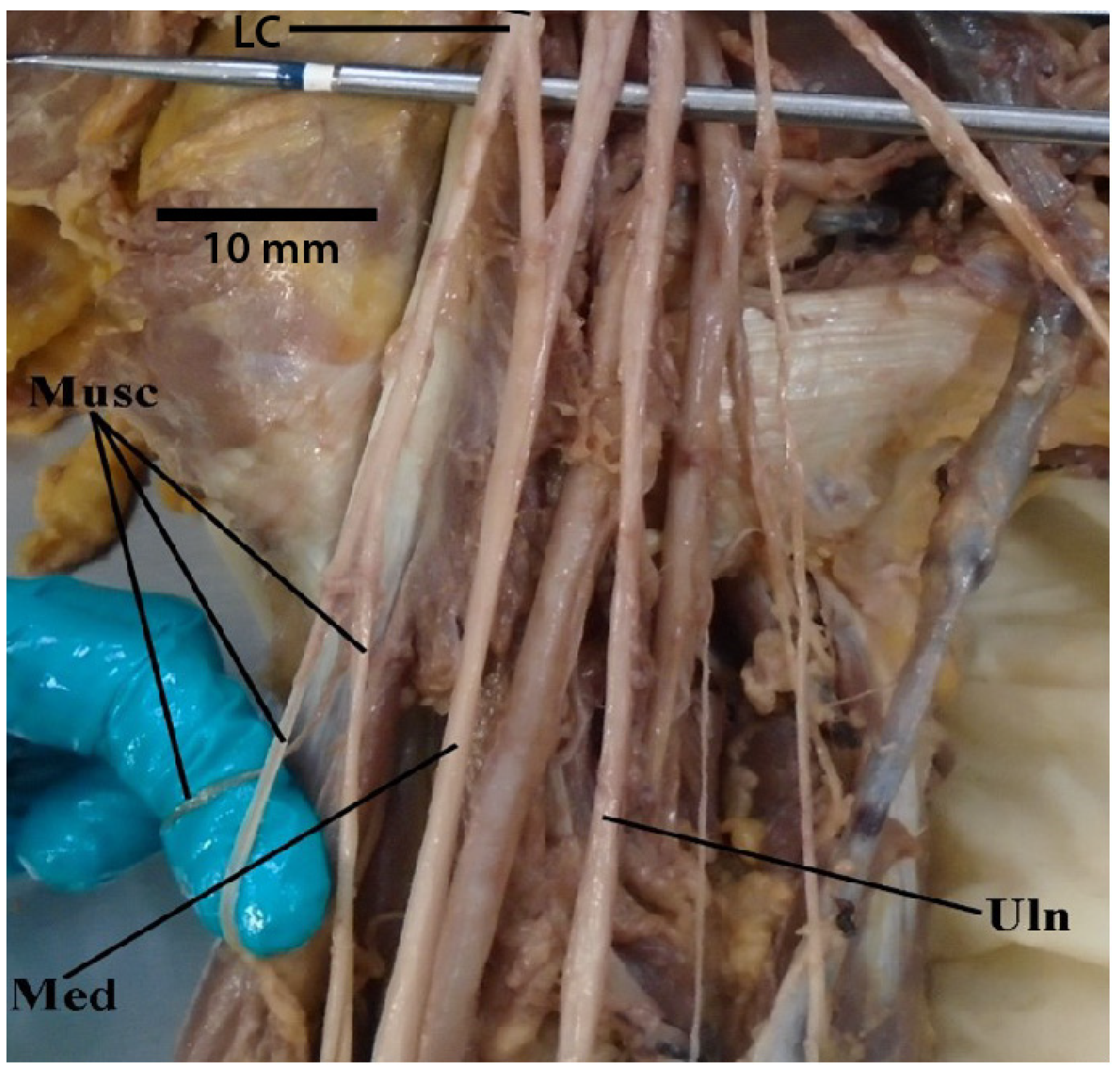 Diagnostics 13 00830 g005 Diagnostics 13 00830 g005