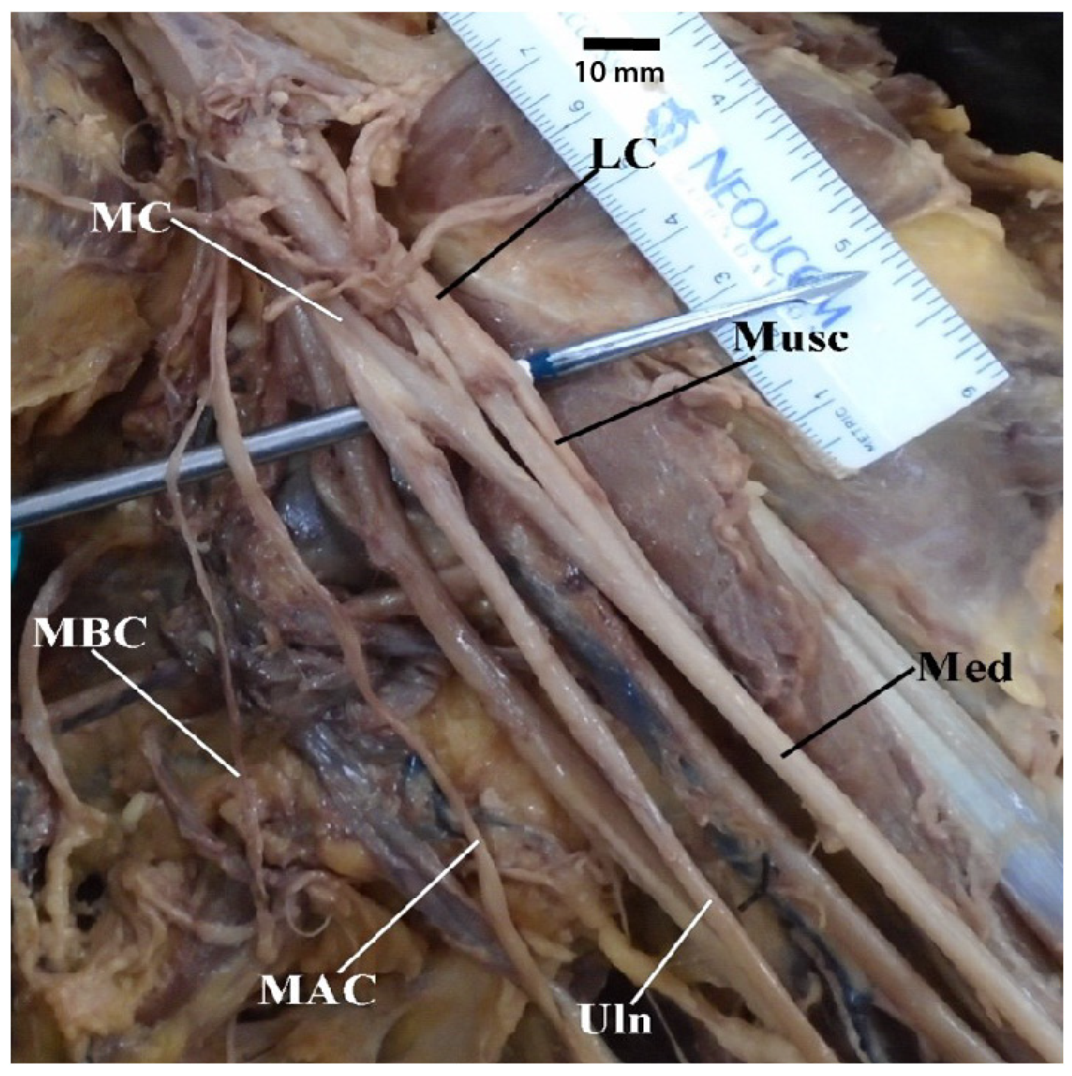 Diagnostics 13 00830 g006 Diagnostics 13 00830 g006