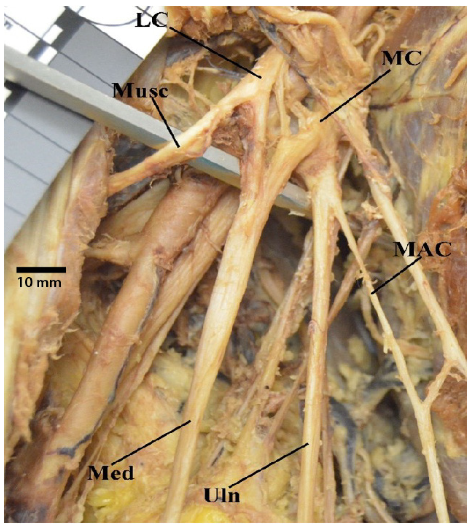 Diagnostics 13 00830 g008 Diagnostics 13 00830 g008