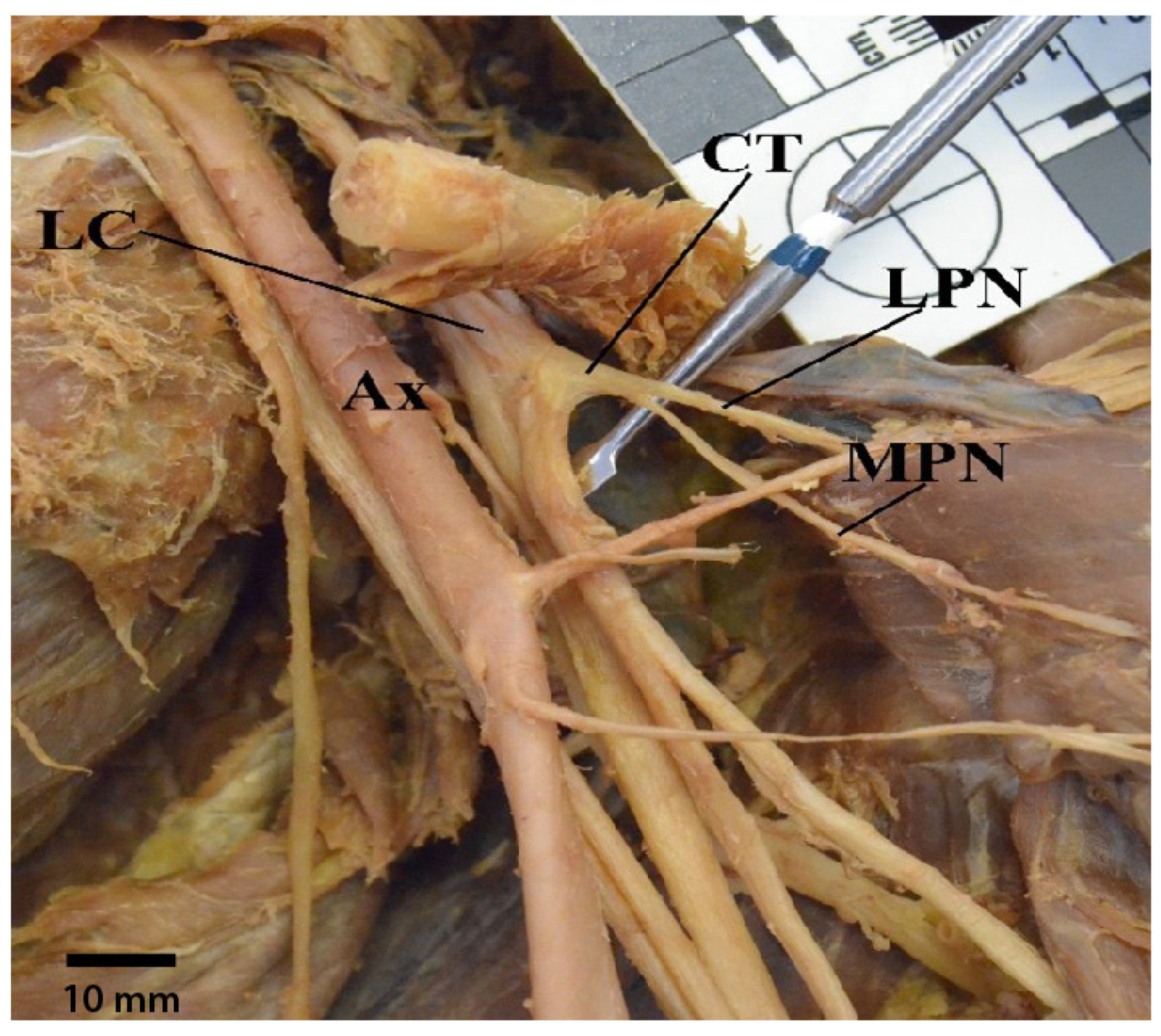 Diagnostics 13 00830 g010 Diagnostics 13 00830 g010