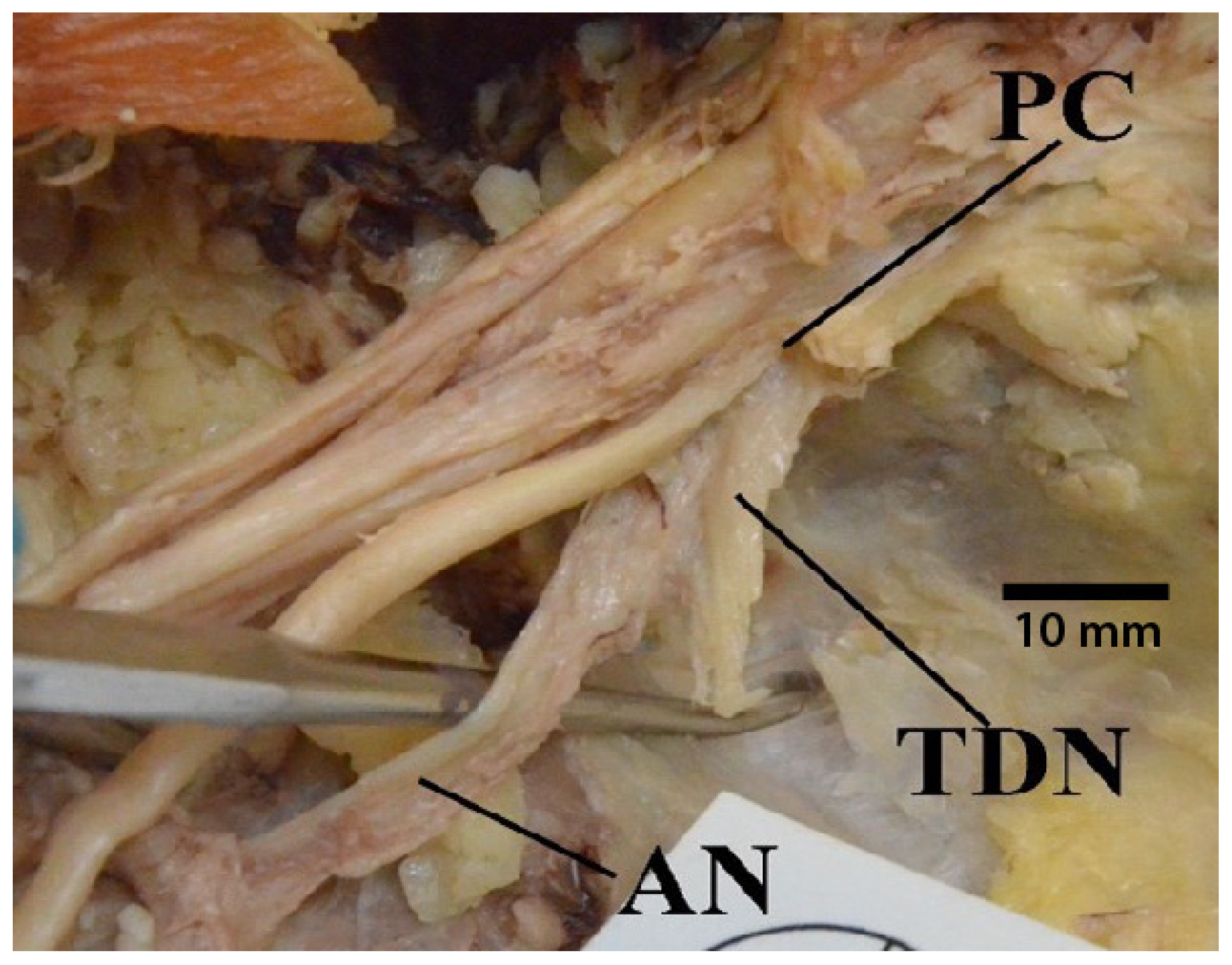 Diagnostics 13 00830 g011 Diagnostics 13 00830 g011