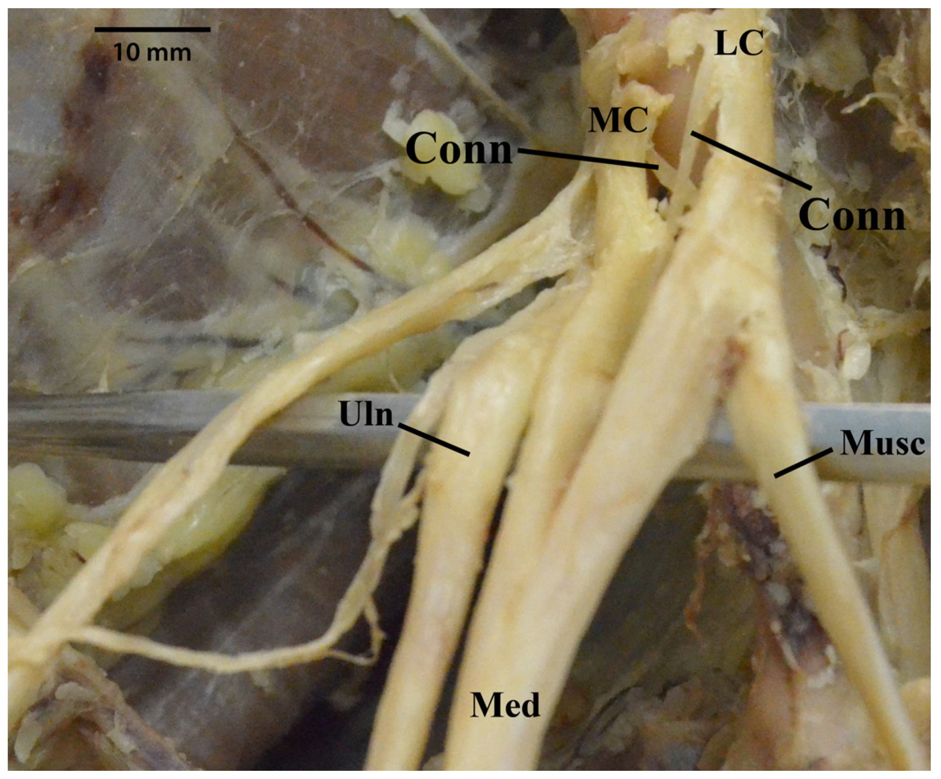 Diagnostics 13 00830 g012 Diagnostics 13 00830 g012