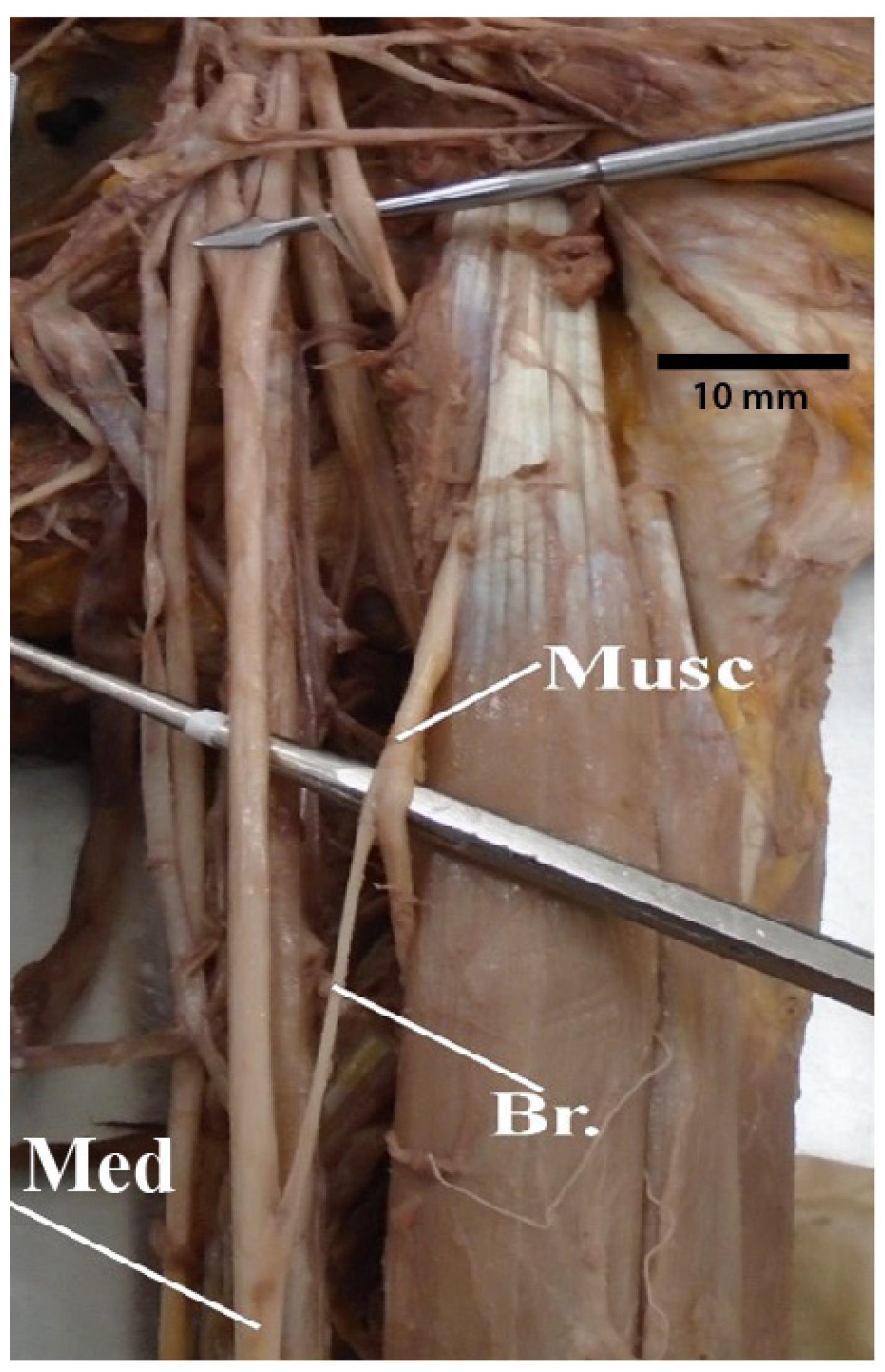 Diagnostics 13 00830 g013 Diagnostics 13 00830 g013