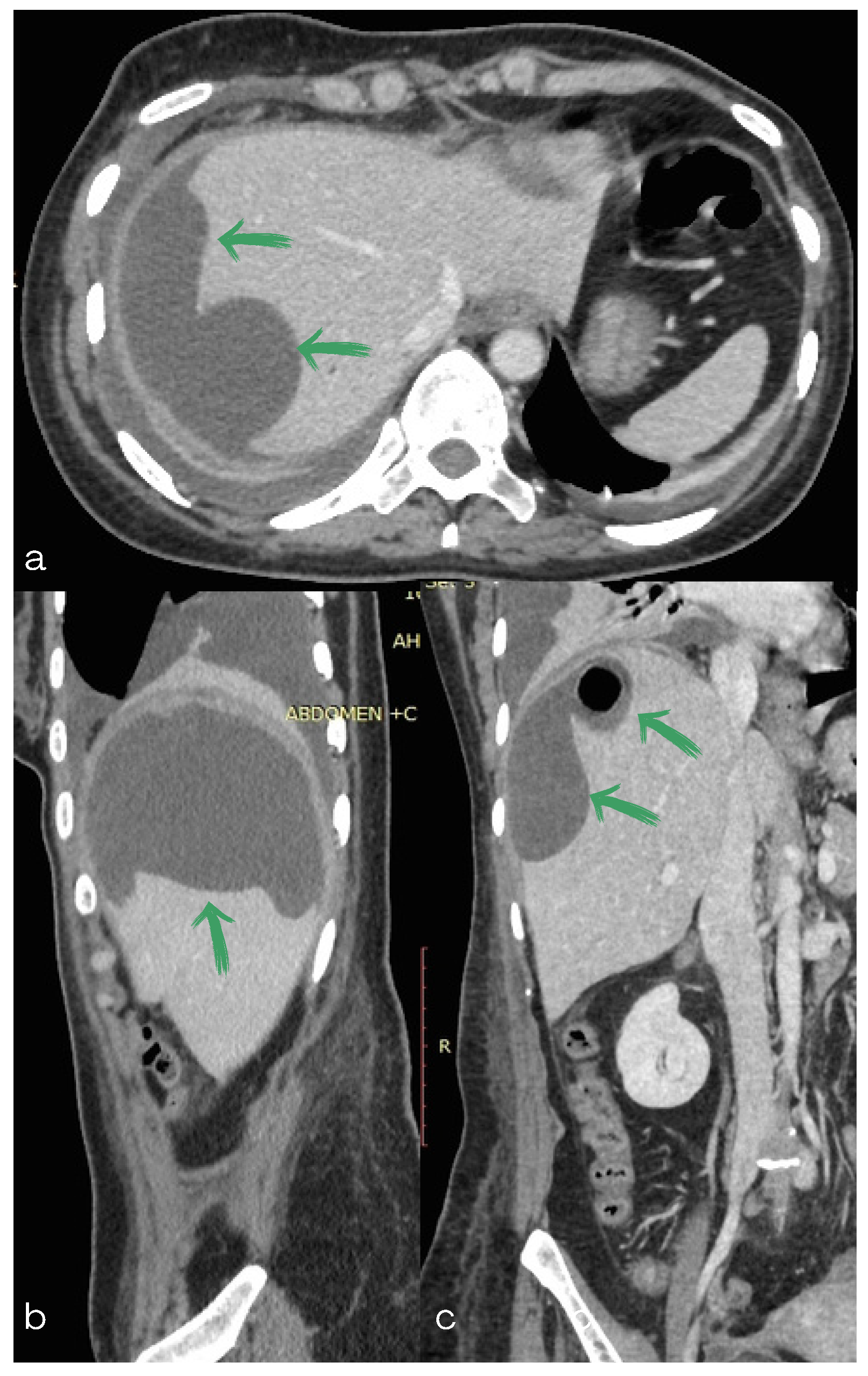 Diagnostics 13 00831 g002