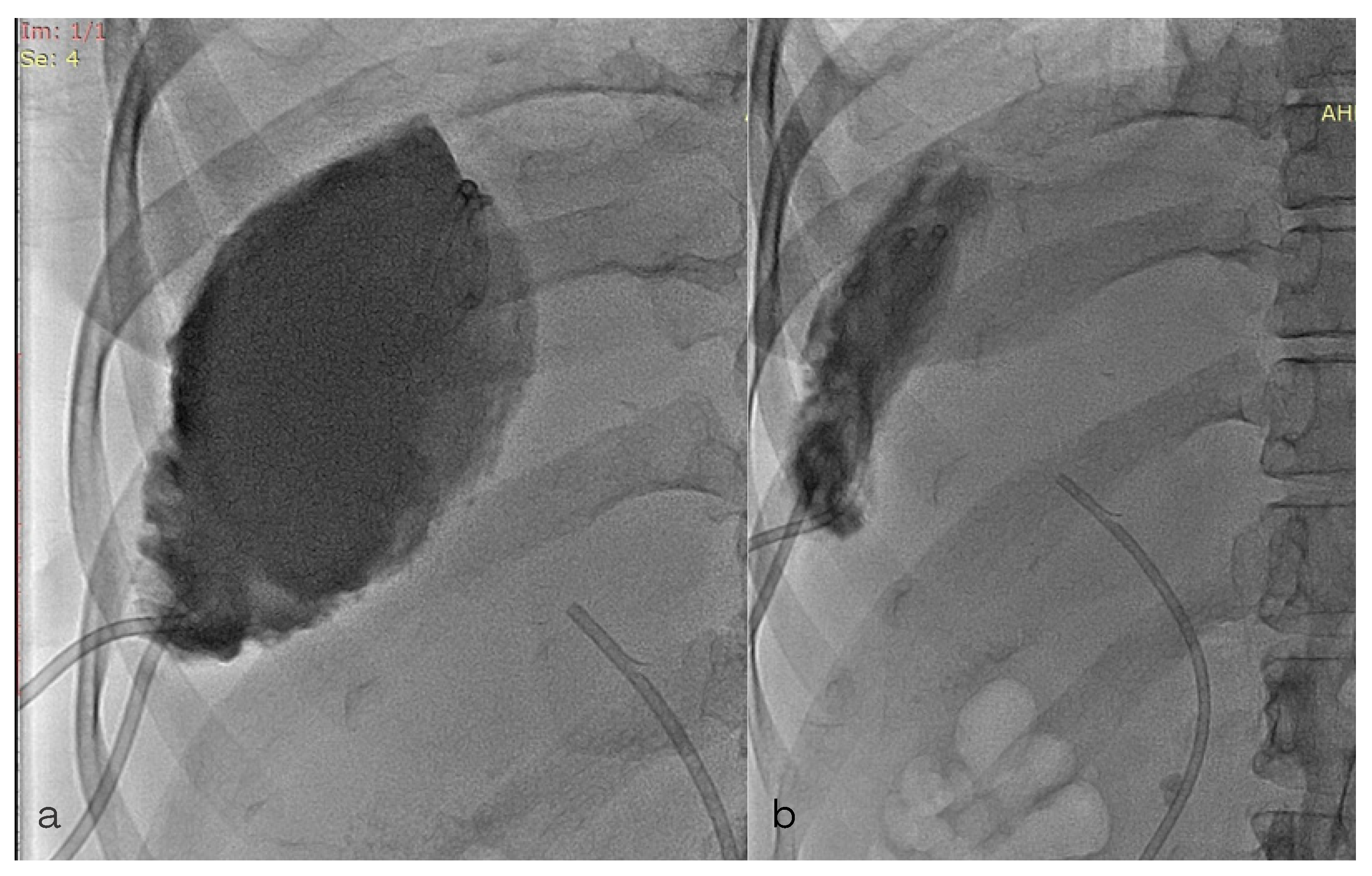 Diagnostics 13 00831 g005