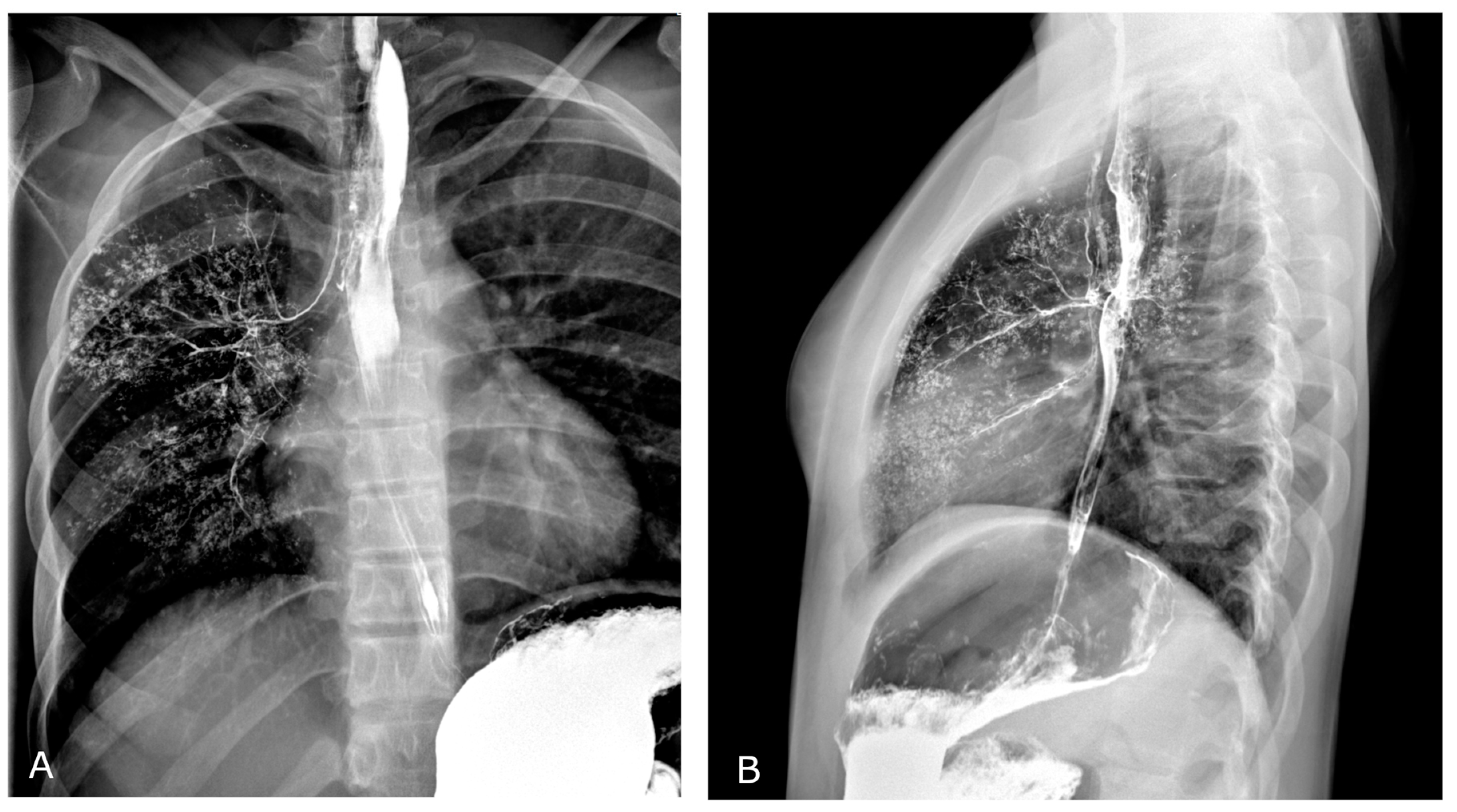 Diagnostics 13 00832 g004 Diagnostics 13 00832 g004