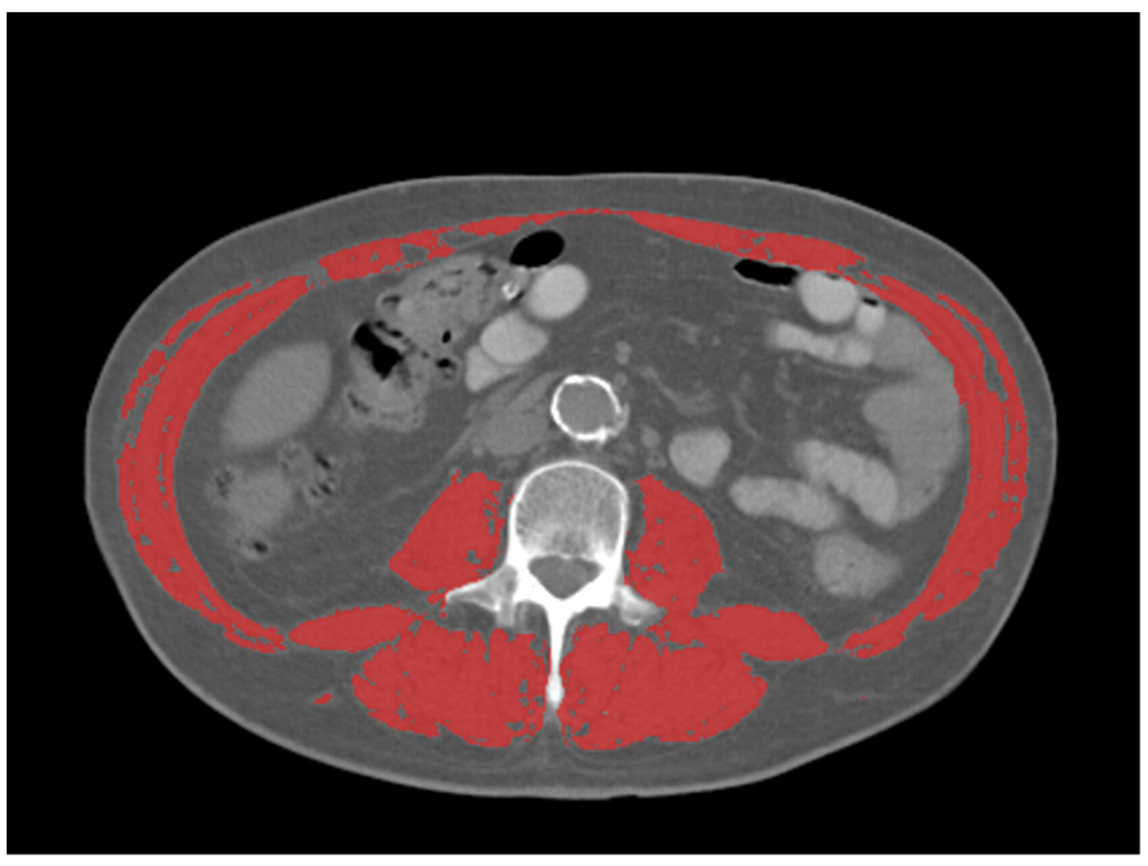 Diagnostics 13 00838 g001