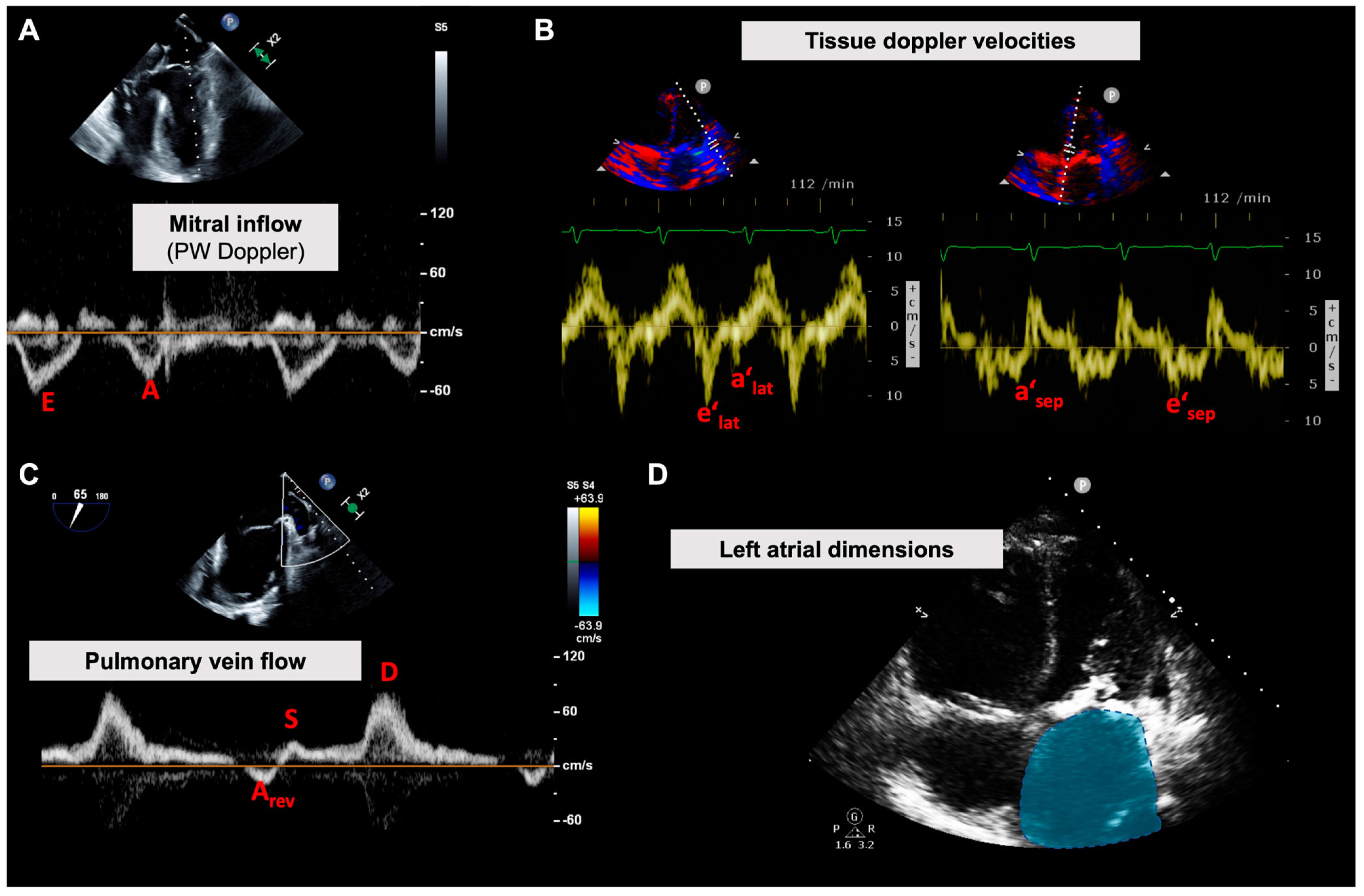 Diagnostics 13 00839 g002 Diagnostics 13 00839 g002