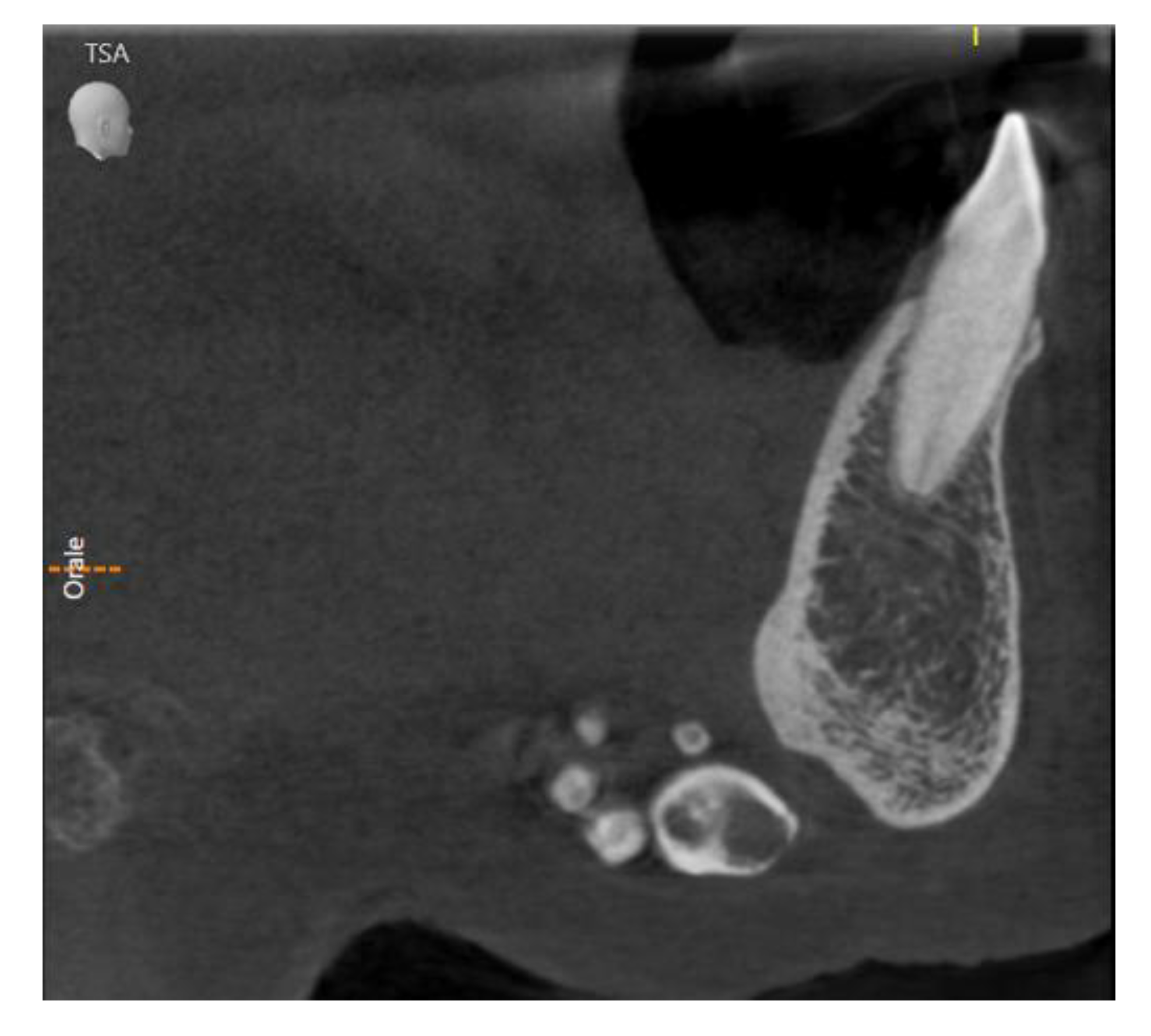 Diagnostics 13 00840 g002