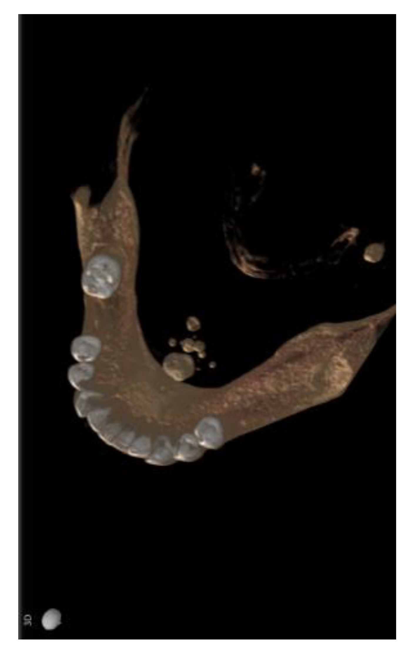 Diagnostics 13 00840 g004