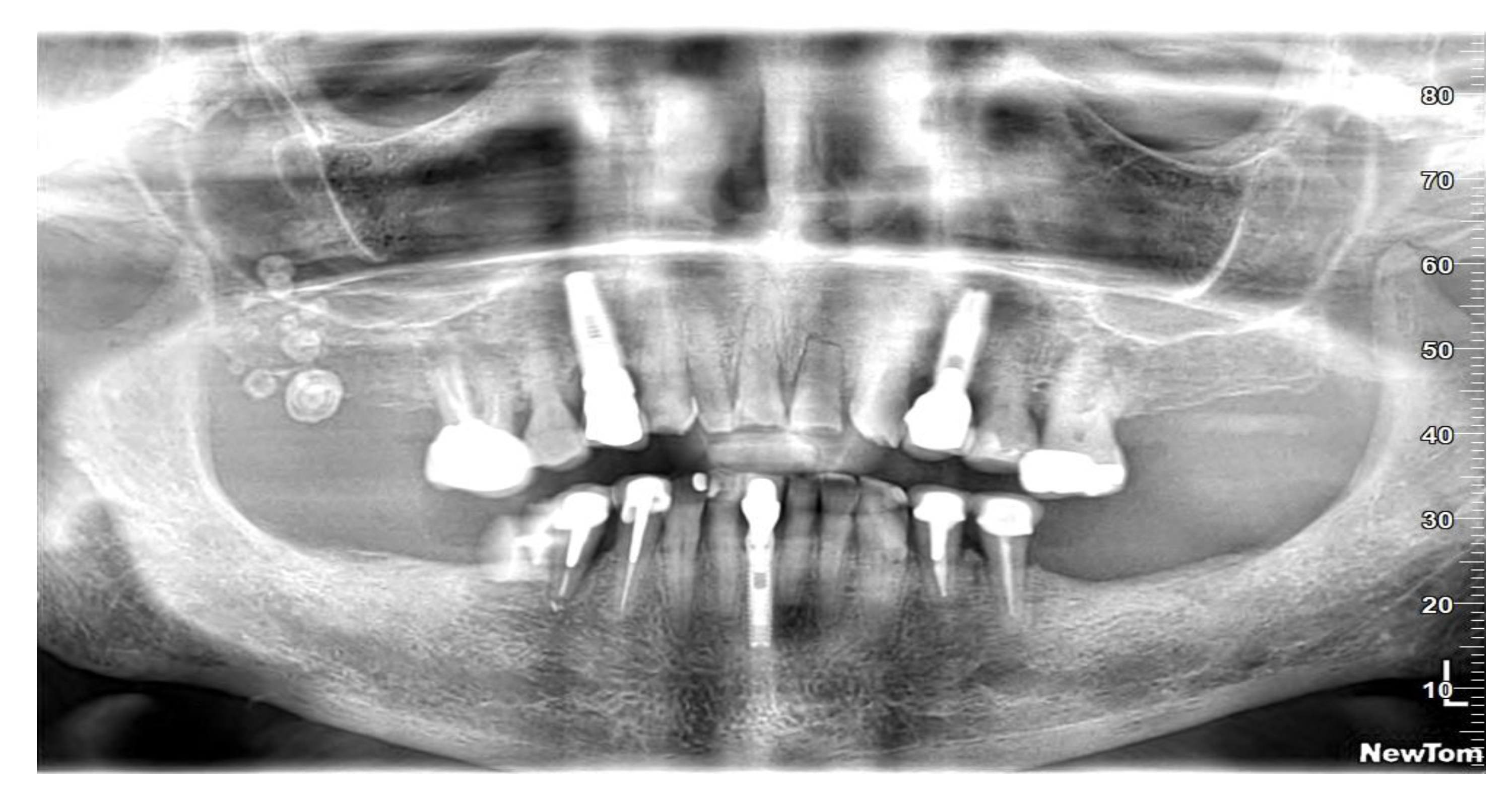 Diagnostics 13 00840 g005