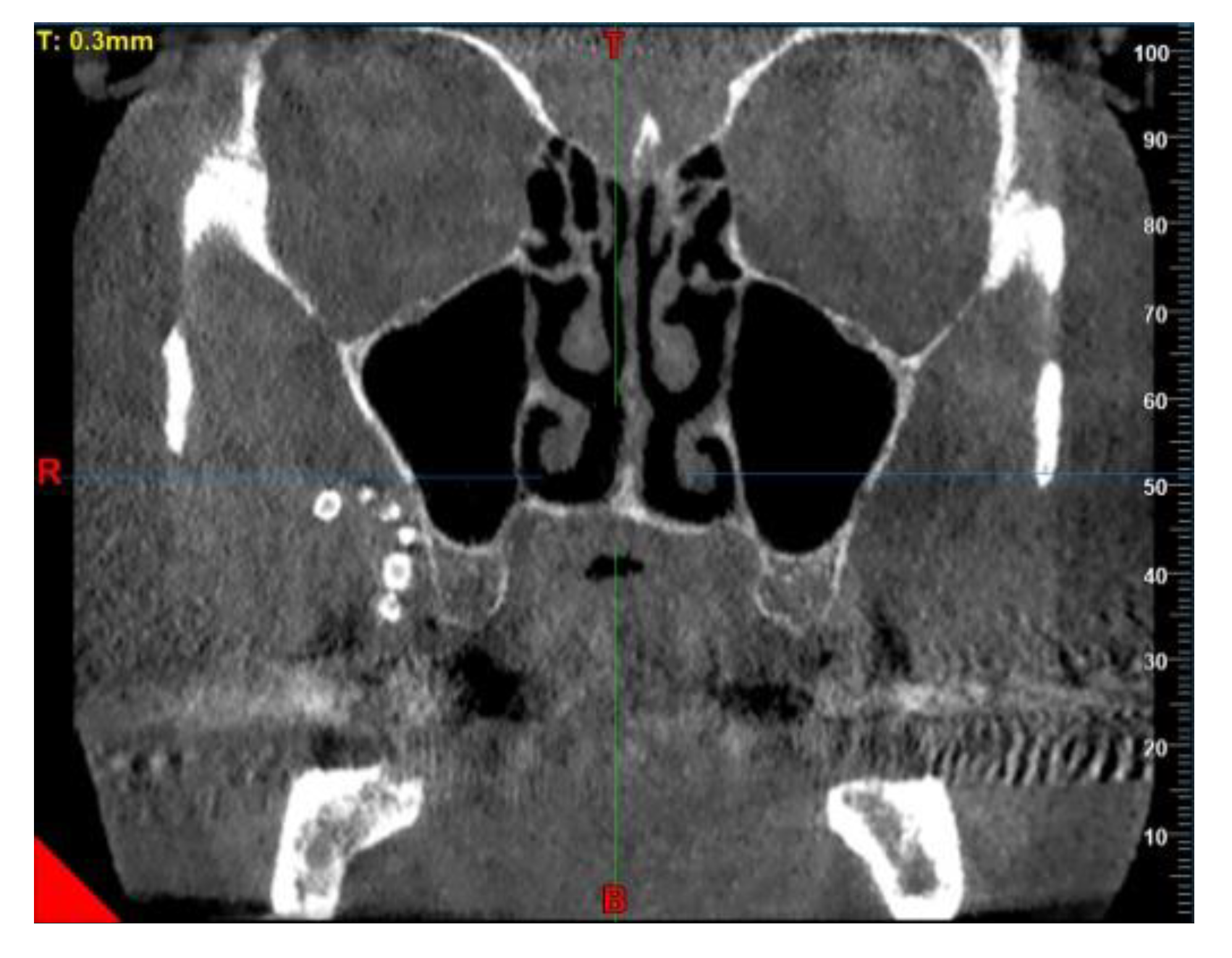 Diagnostics 13 00840 g006