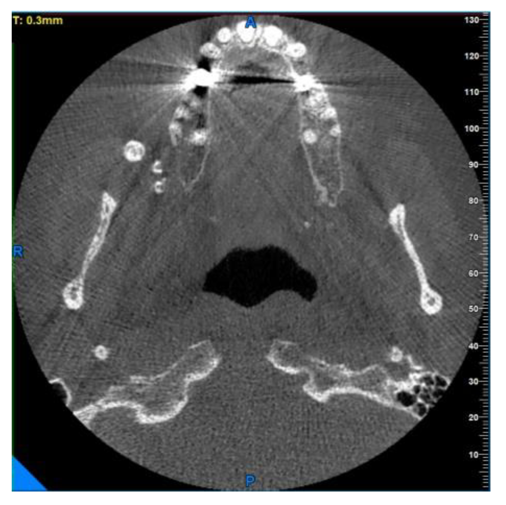 Diagnostics 13 00840 g007