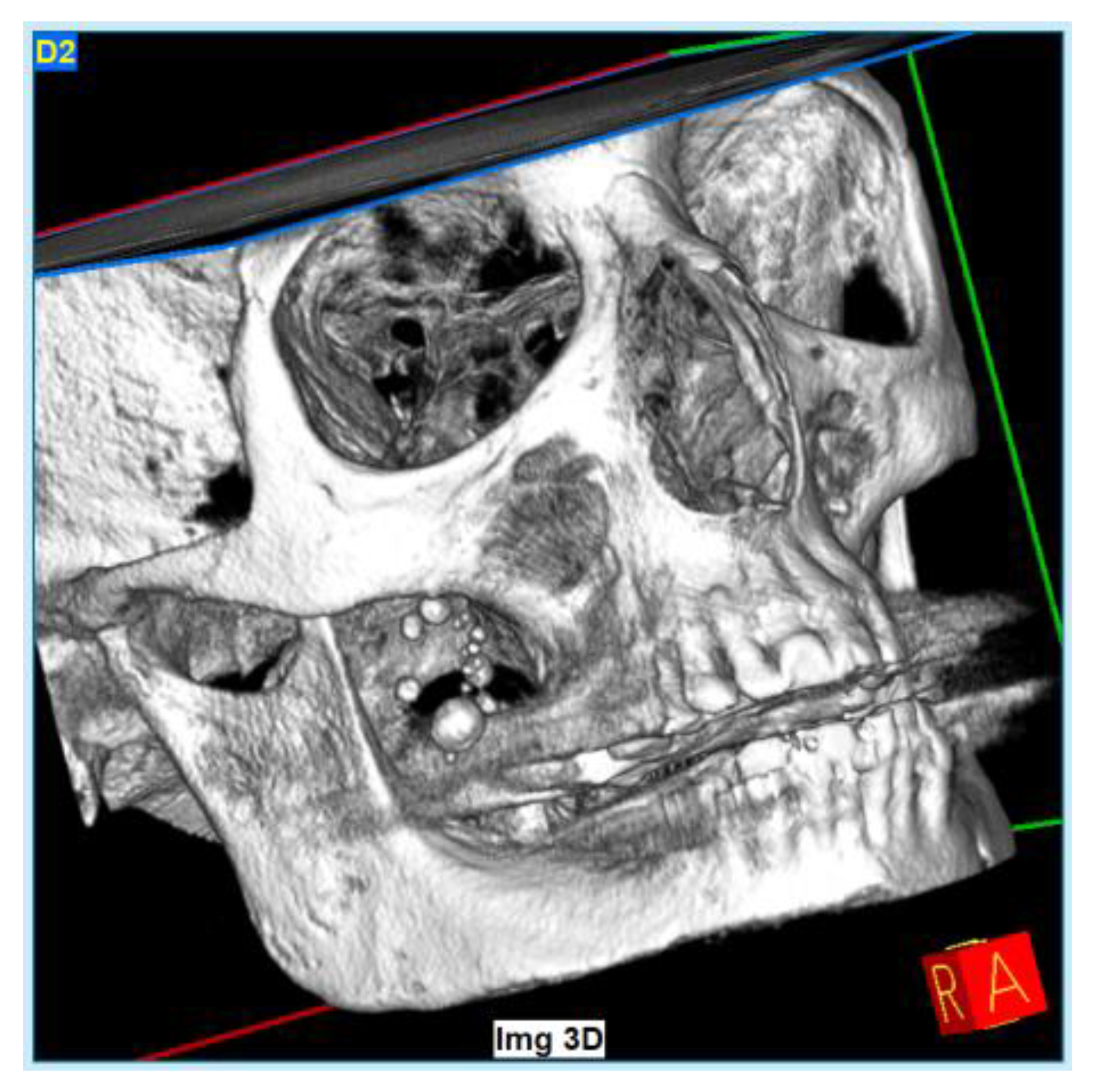 Diagnostics 13 00840 g008