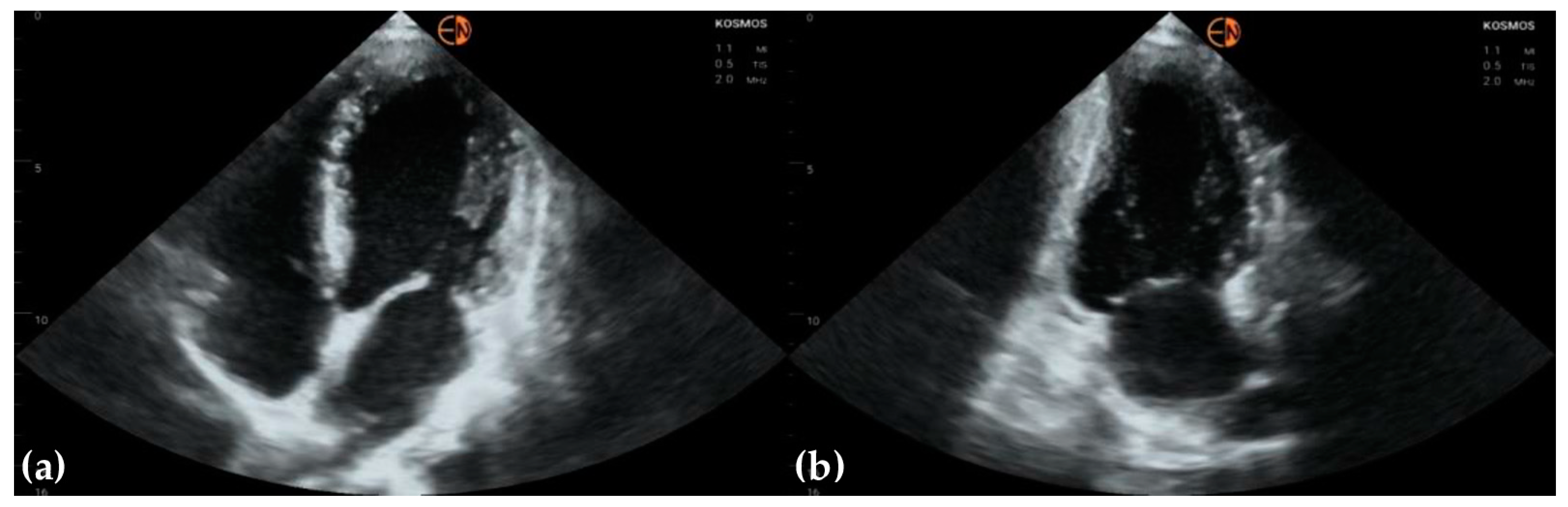 Diagnostics 13 00853 g004