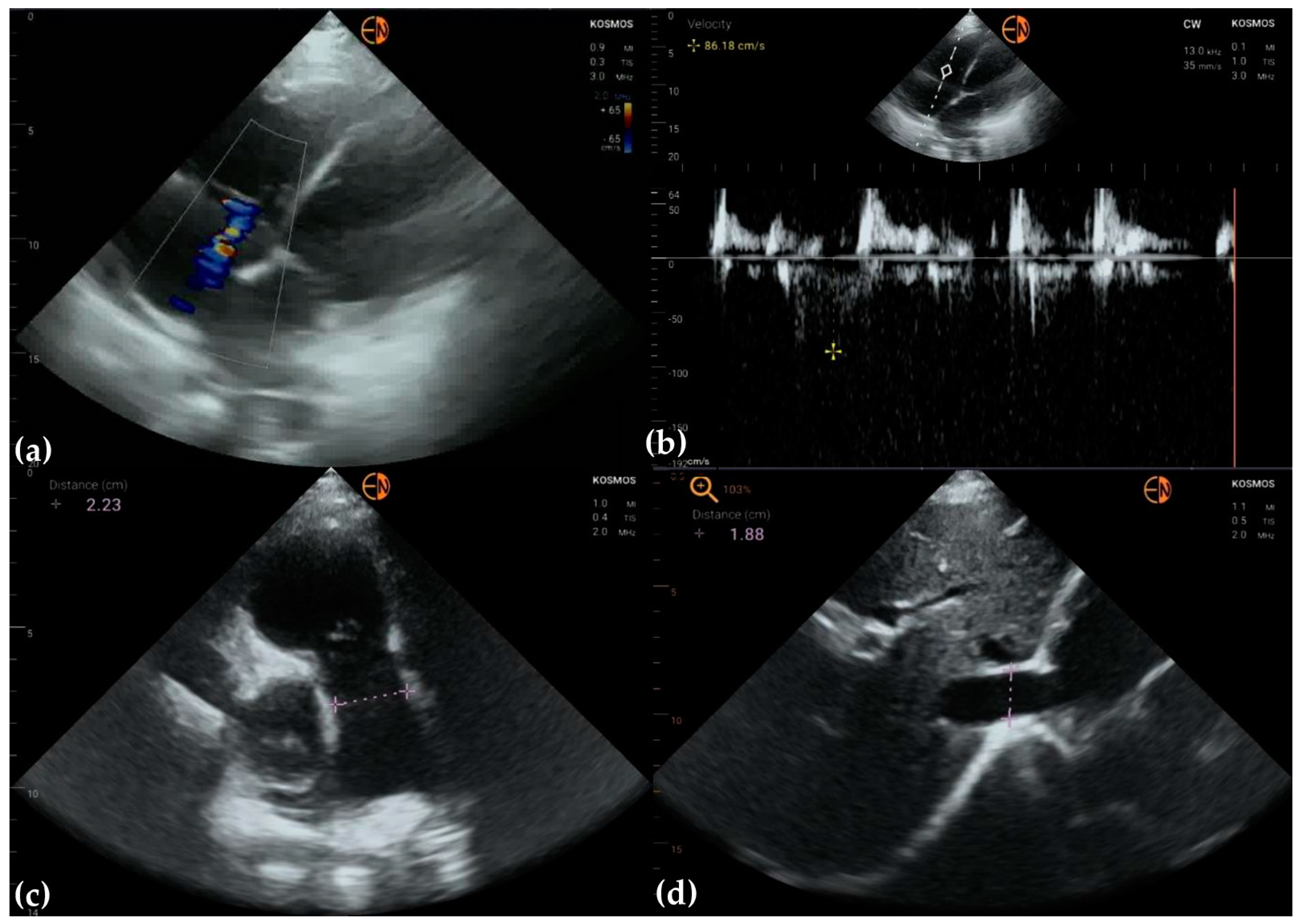 Diagnostics 13 00853 g005
