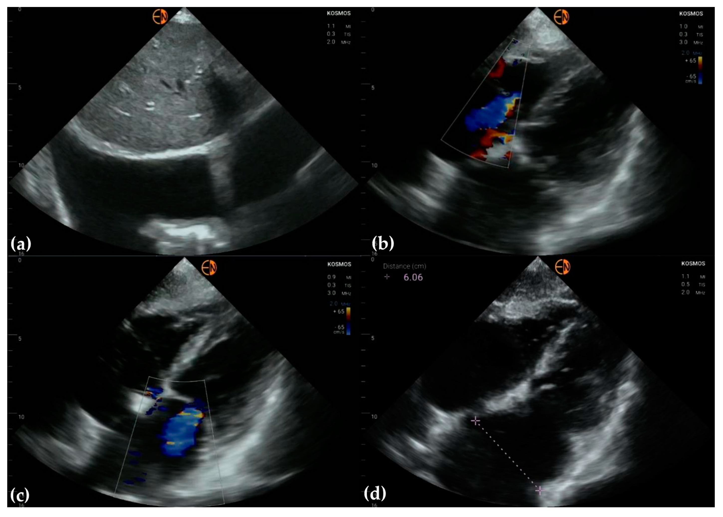 Diagnostics 13 00853 g006
