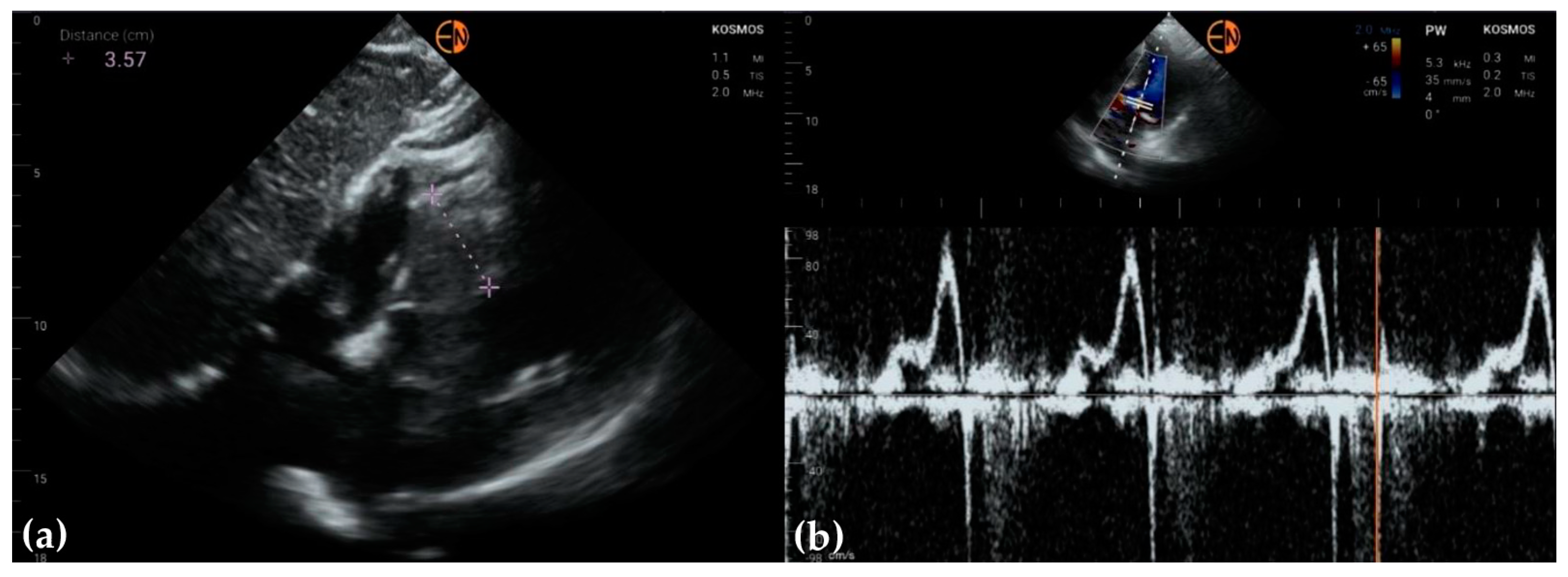 Diagnostics 13 00853 g007