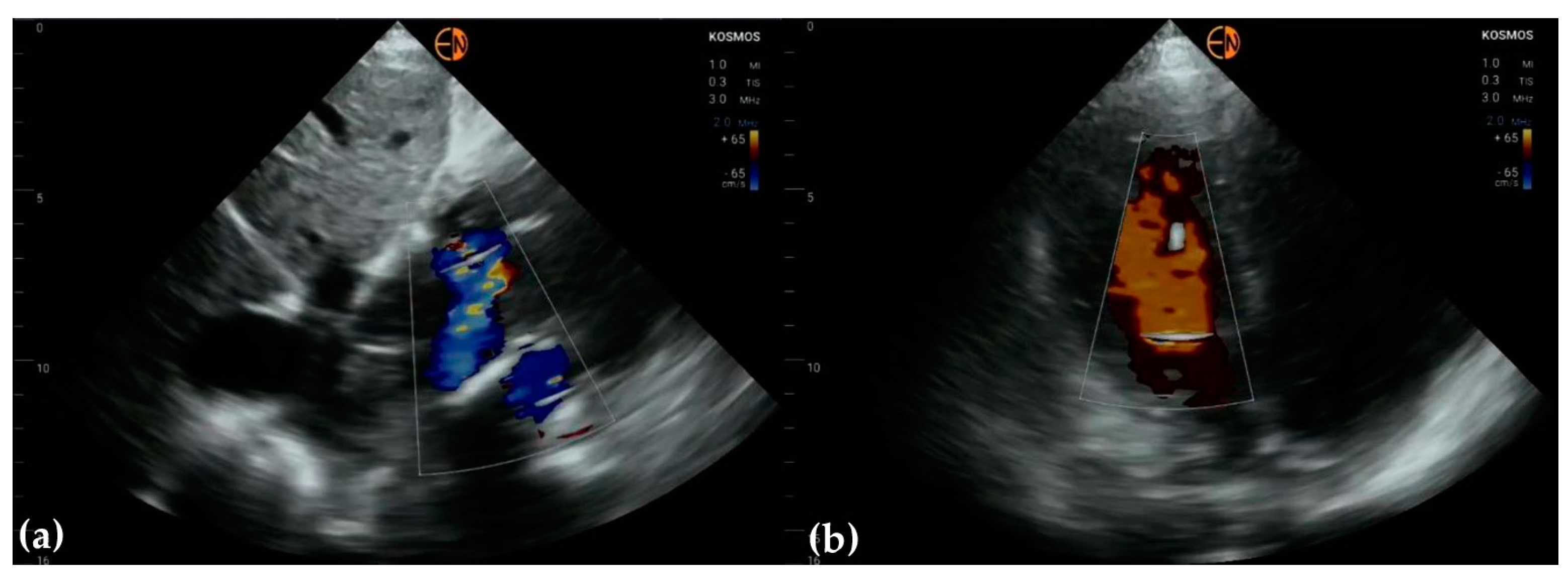 Diagnostics 13 00853 g009