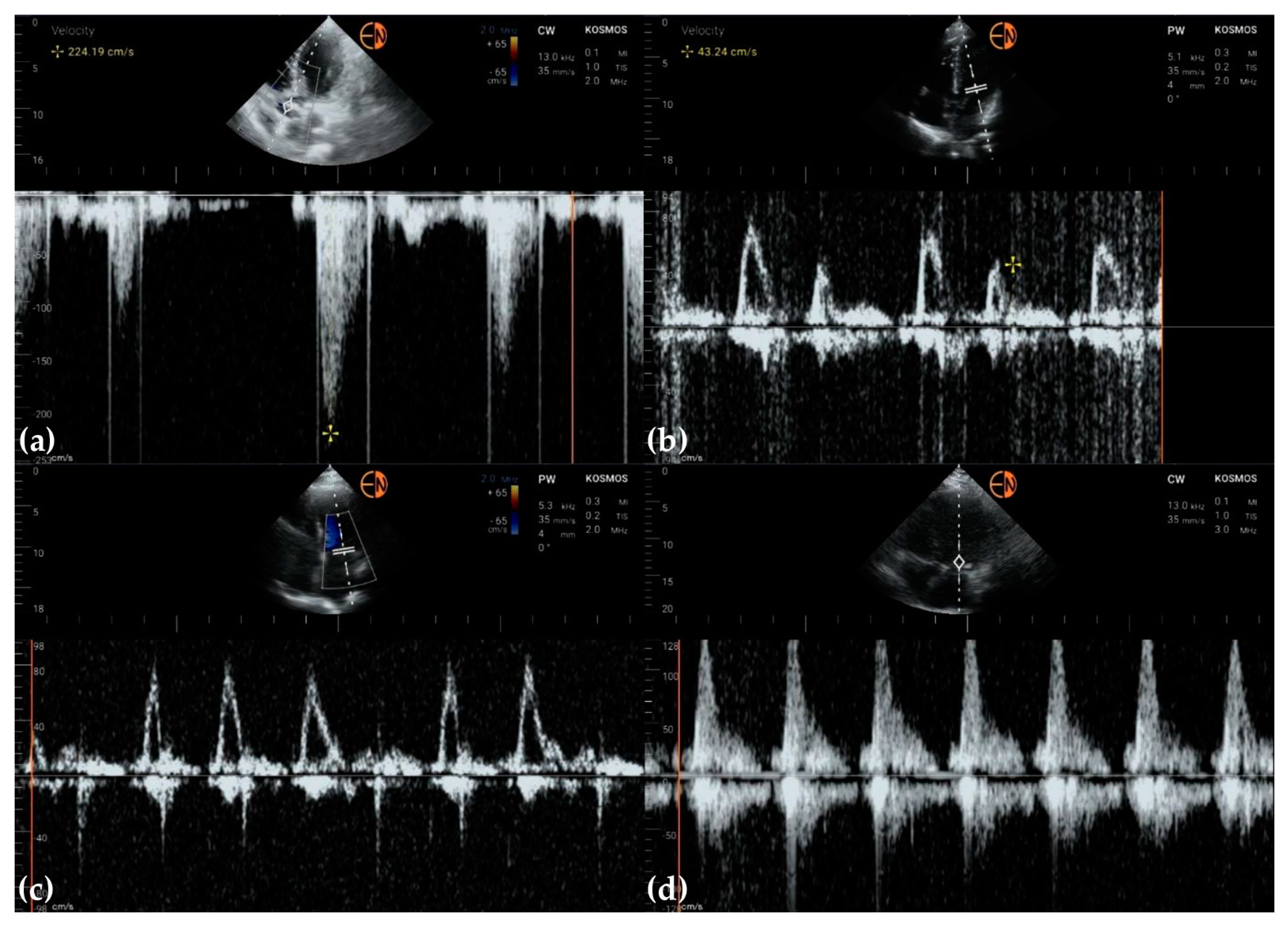 Diagnostics 13 00853 g011