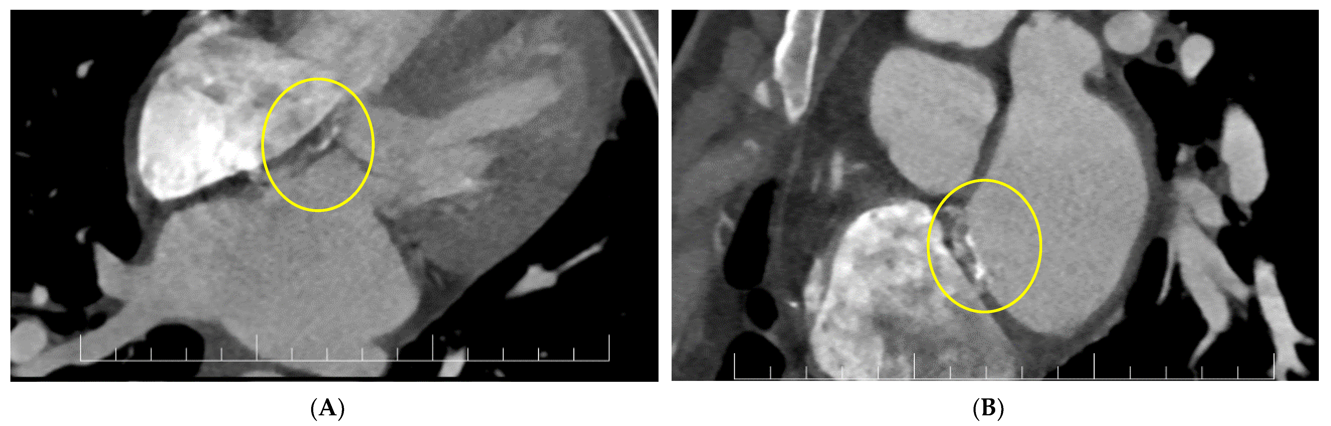 Diagnostics 13 00856 g005