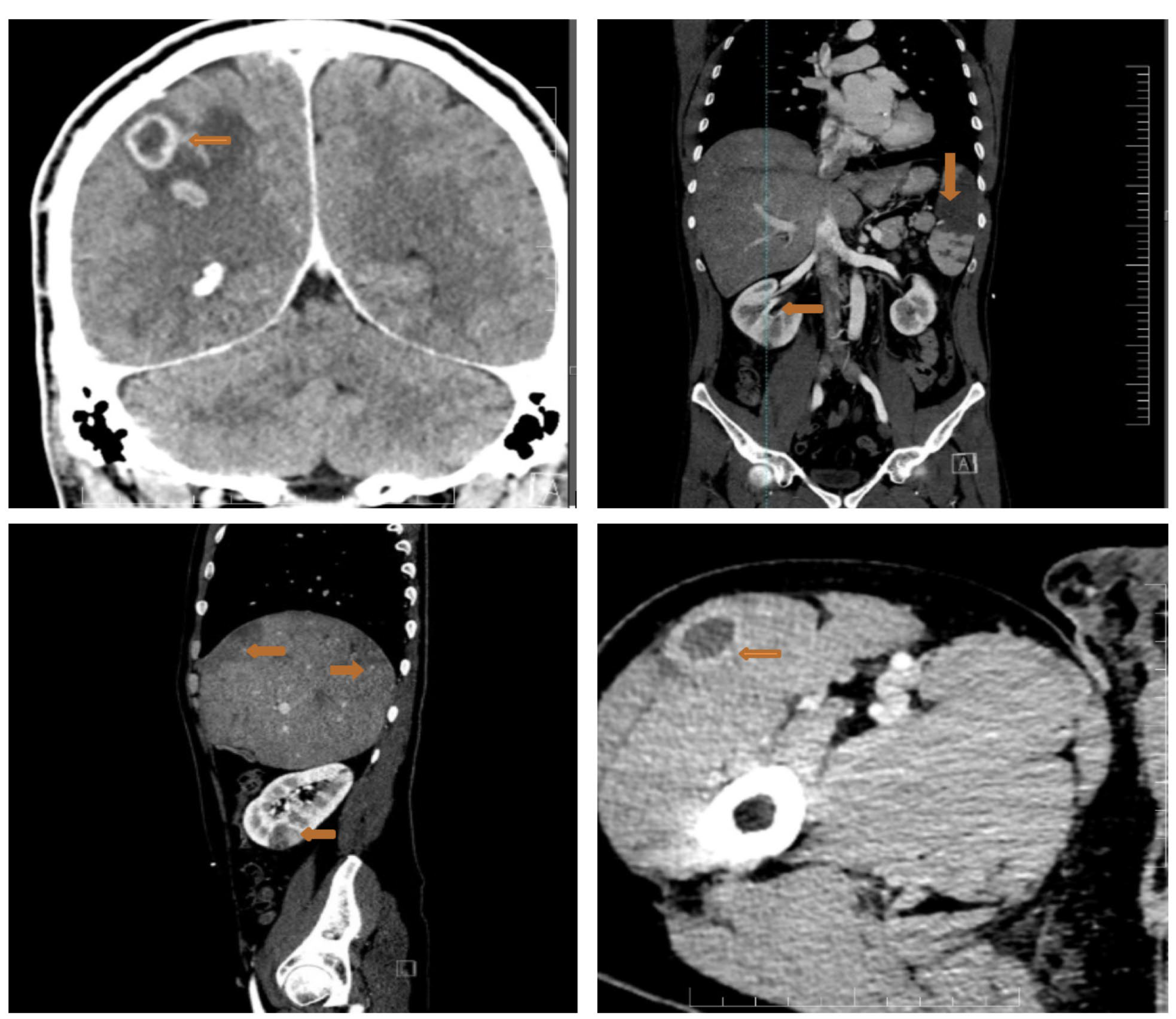 Diagnostics 13 00856 g006