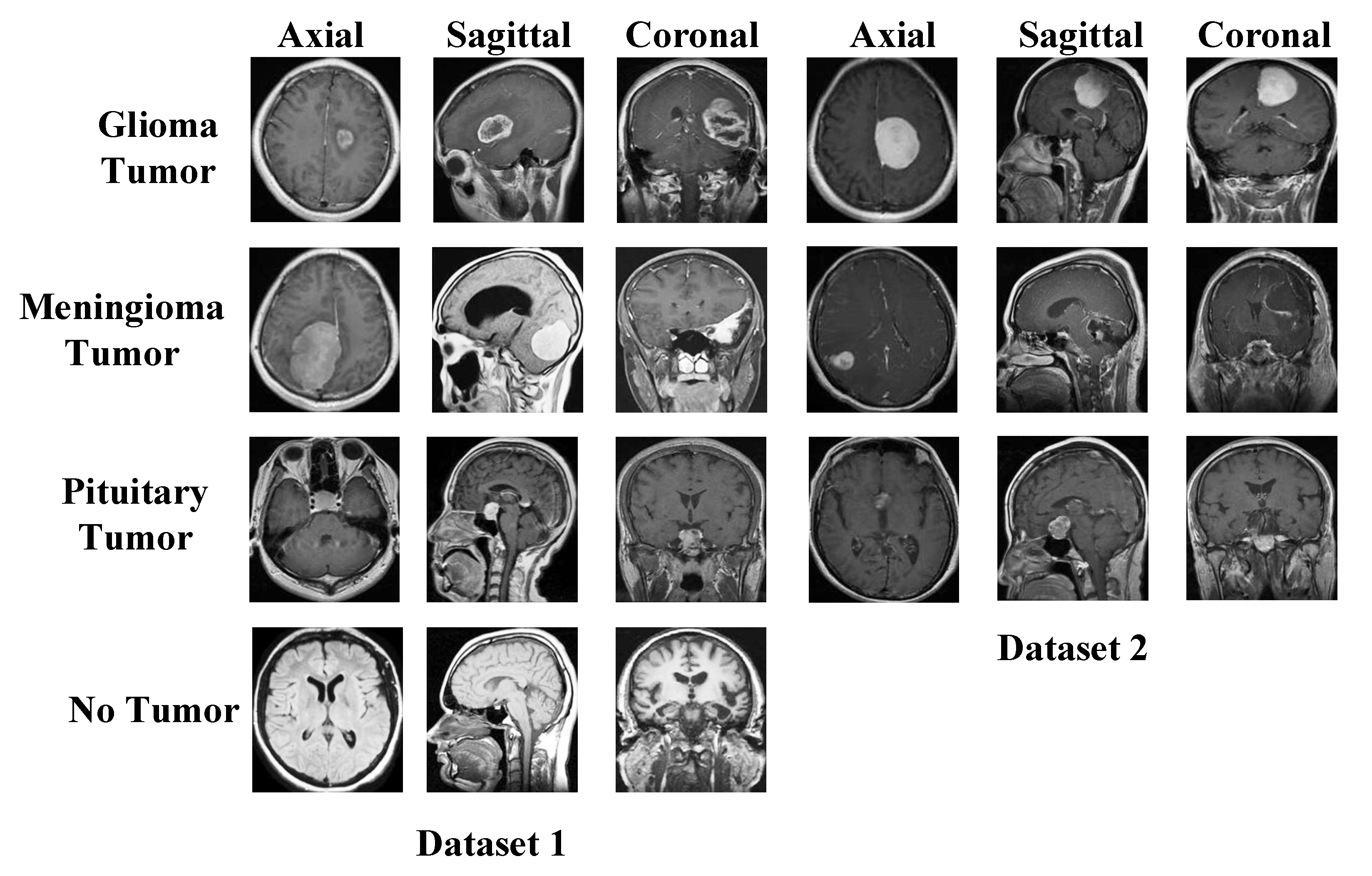 Diagnostics 13 00859 g001