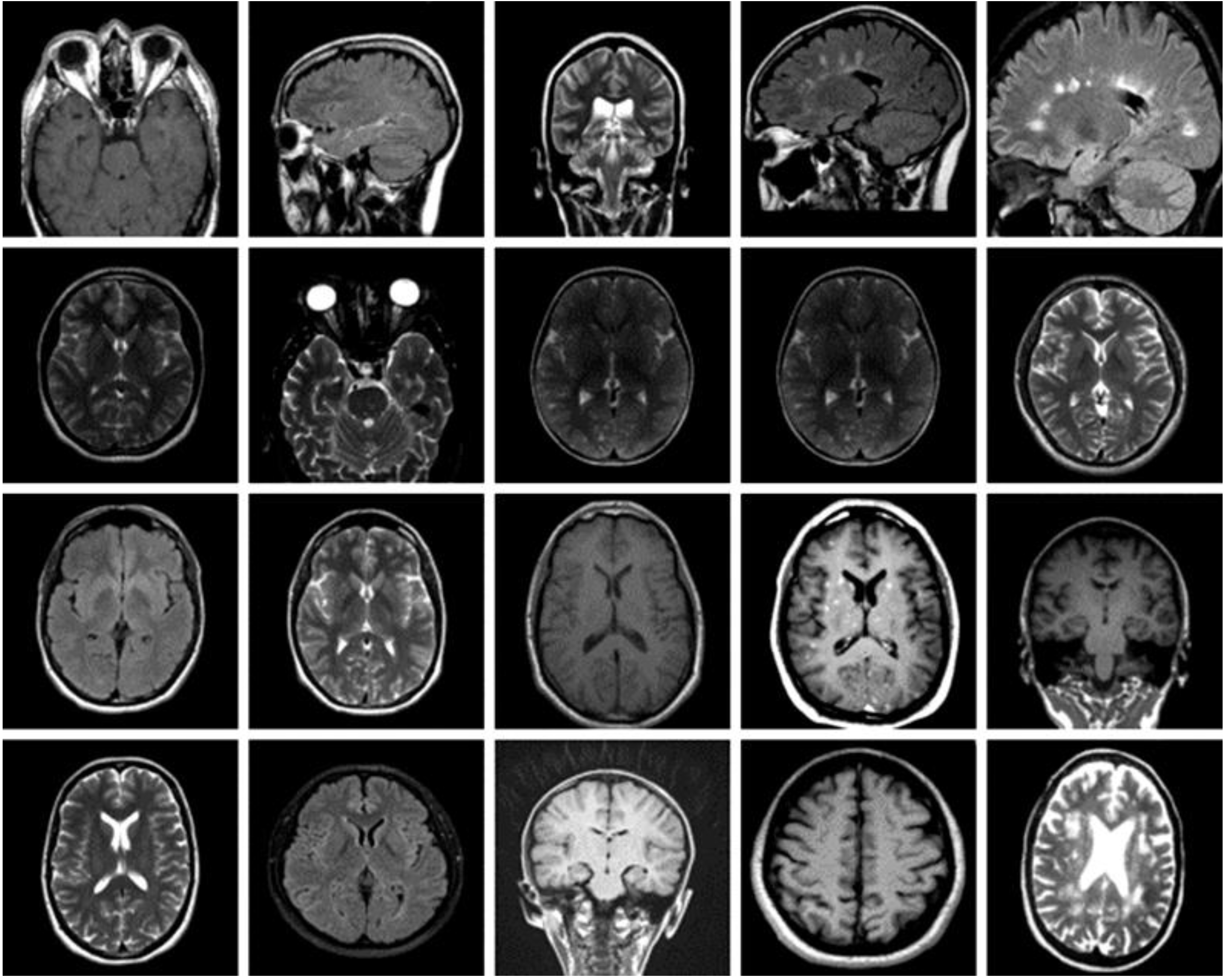 Diagnostics 13 00864 g001