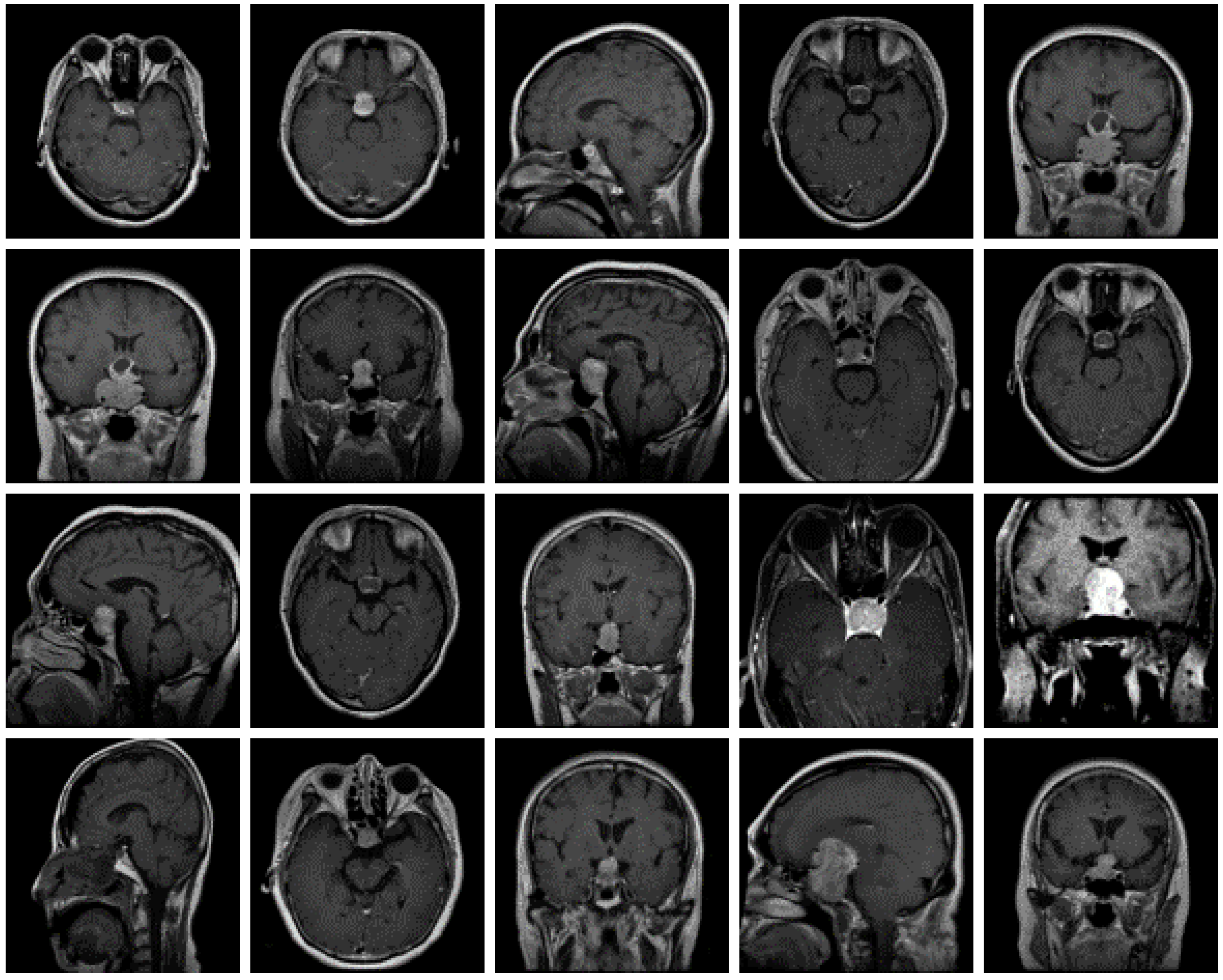 Diagnostics 13 00864 g004