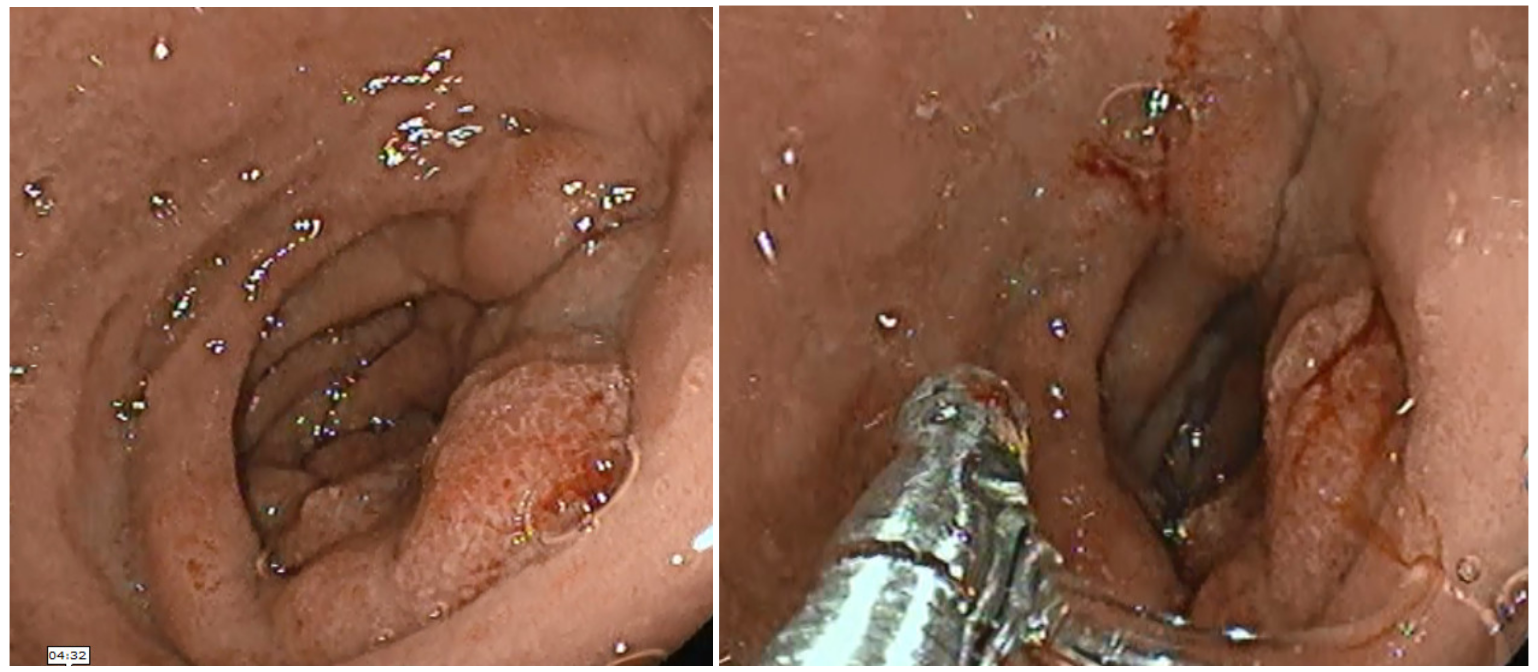 Diagnostics 13 00866 g001