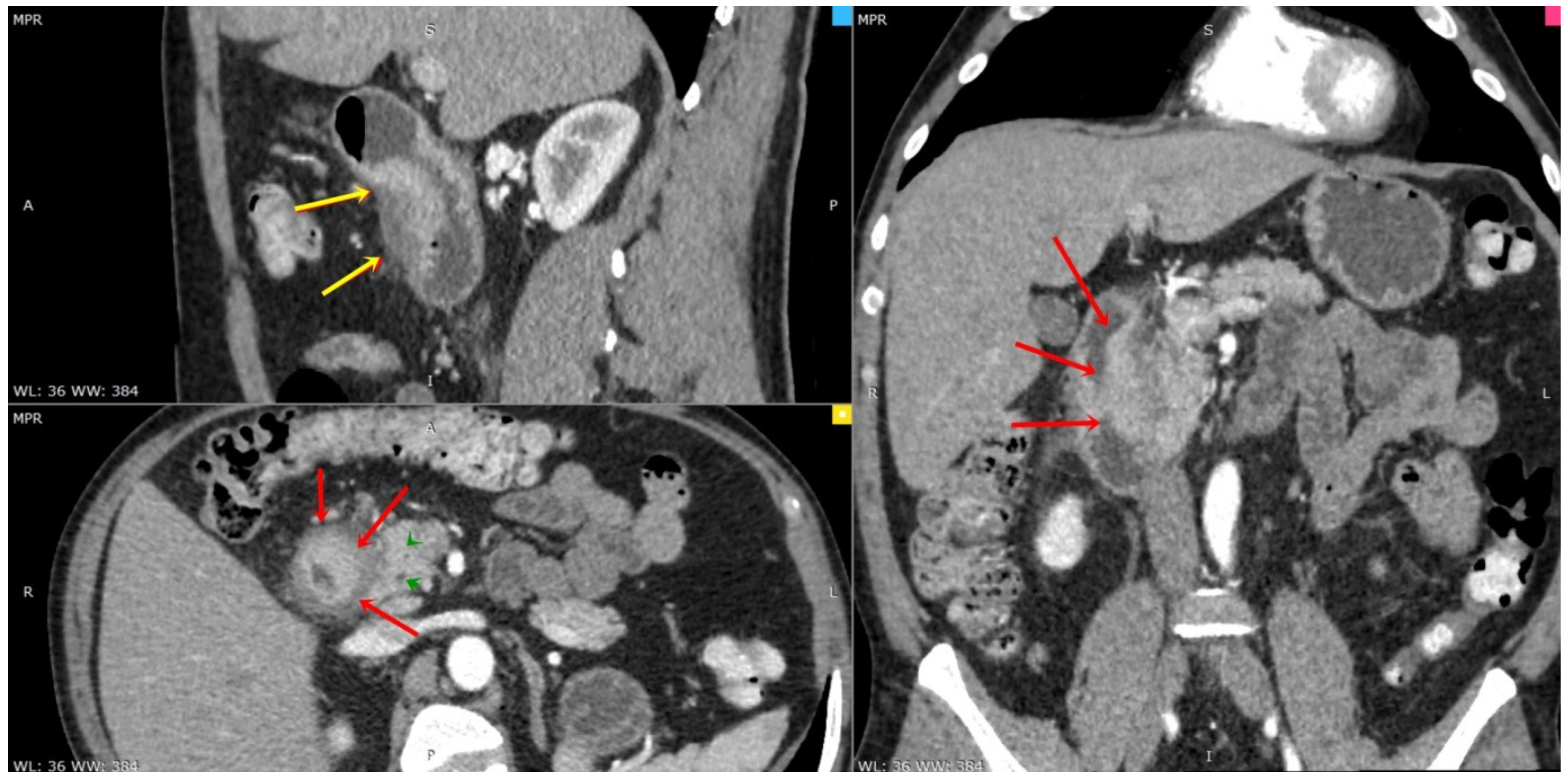 Diagnostics 13 00866 g004