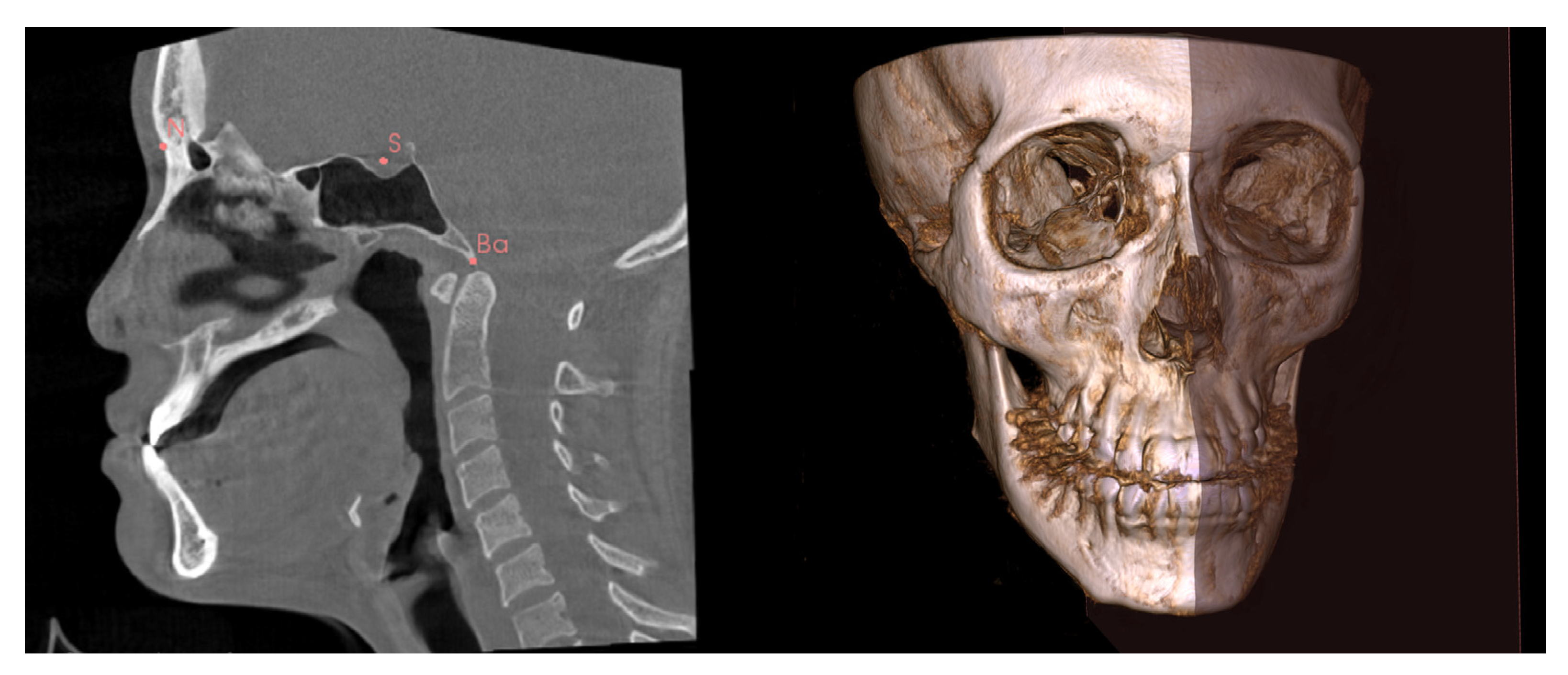 Diagnostics 13 00869 g001