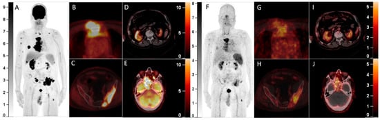 Diagnostics 13 00871 g001