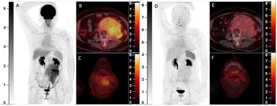 Diagnostics 13 00871 g002