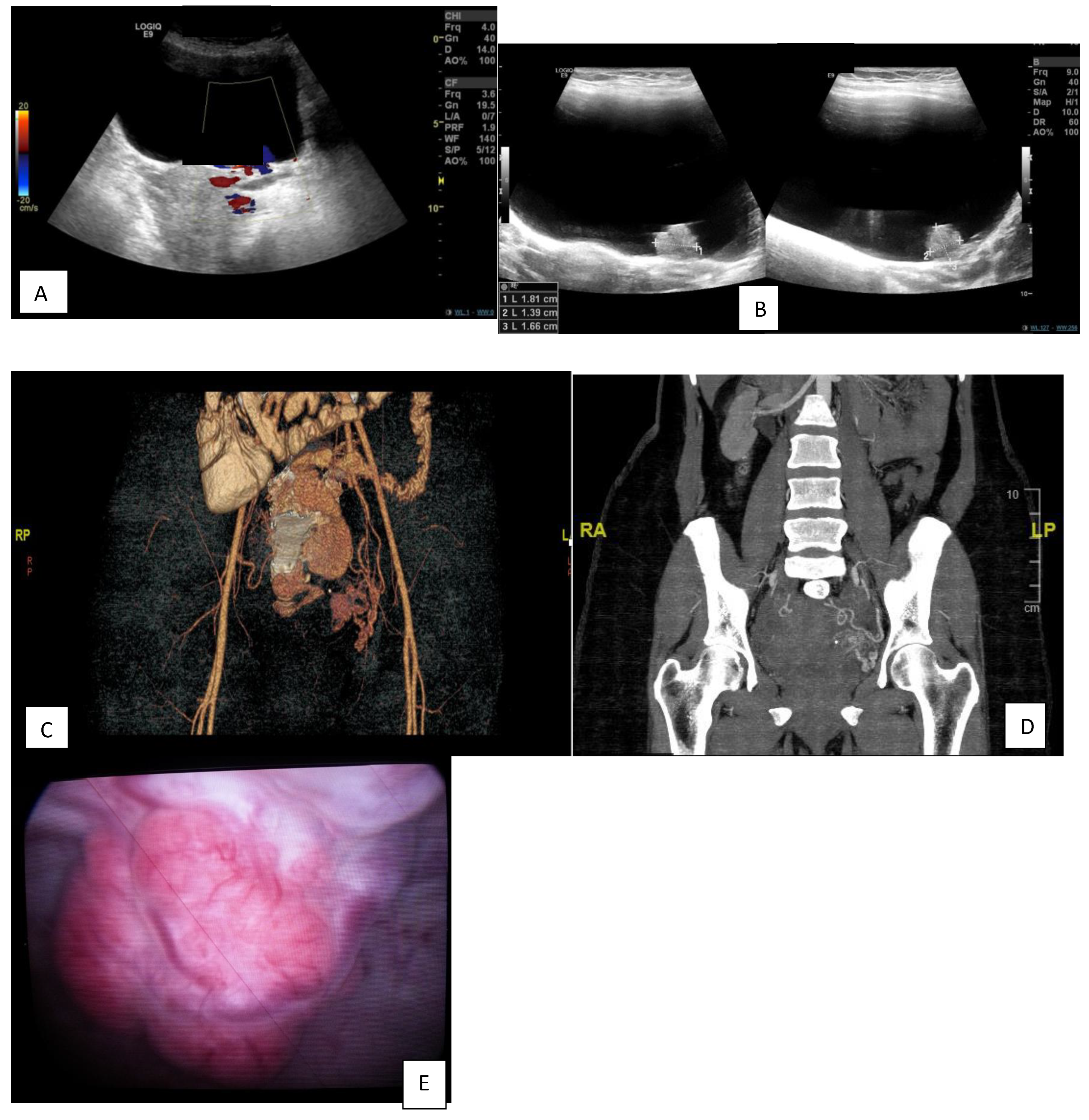 Diagnostics 13 00875 g001