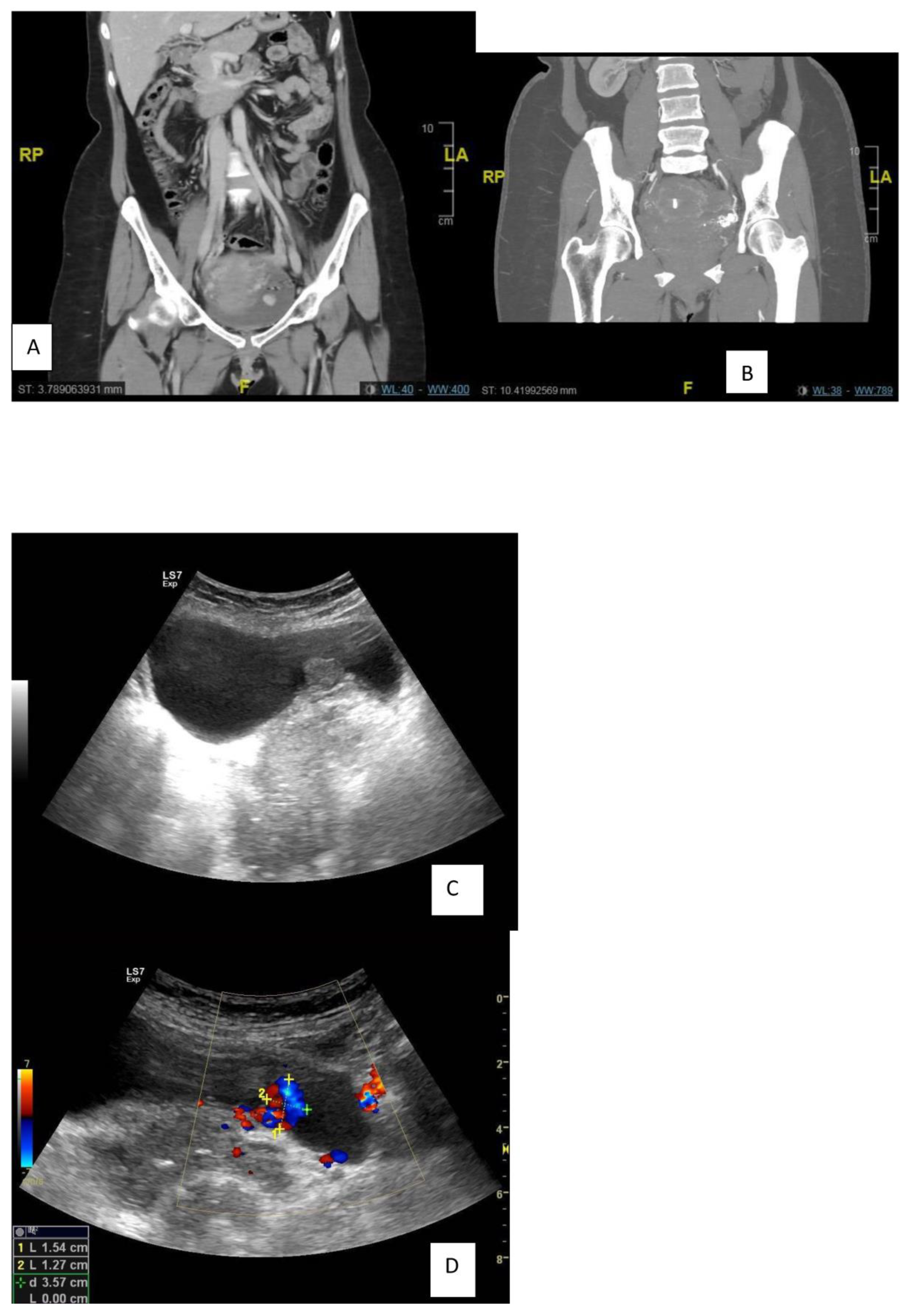Diagnostics 13 00875 g002