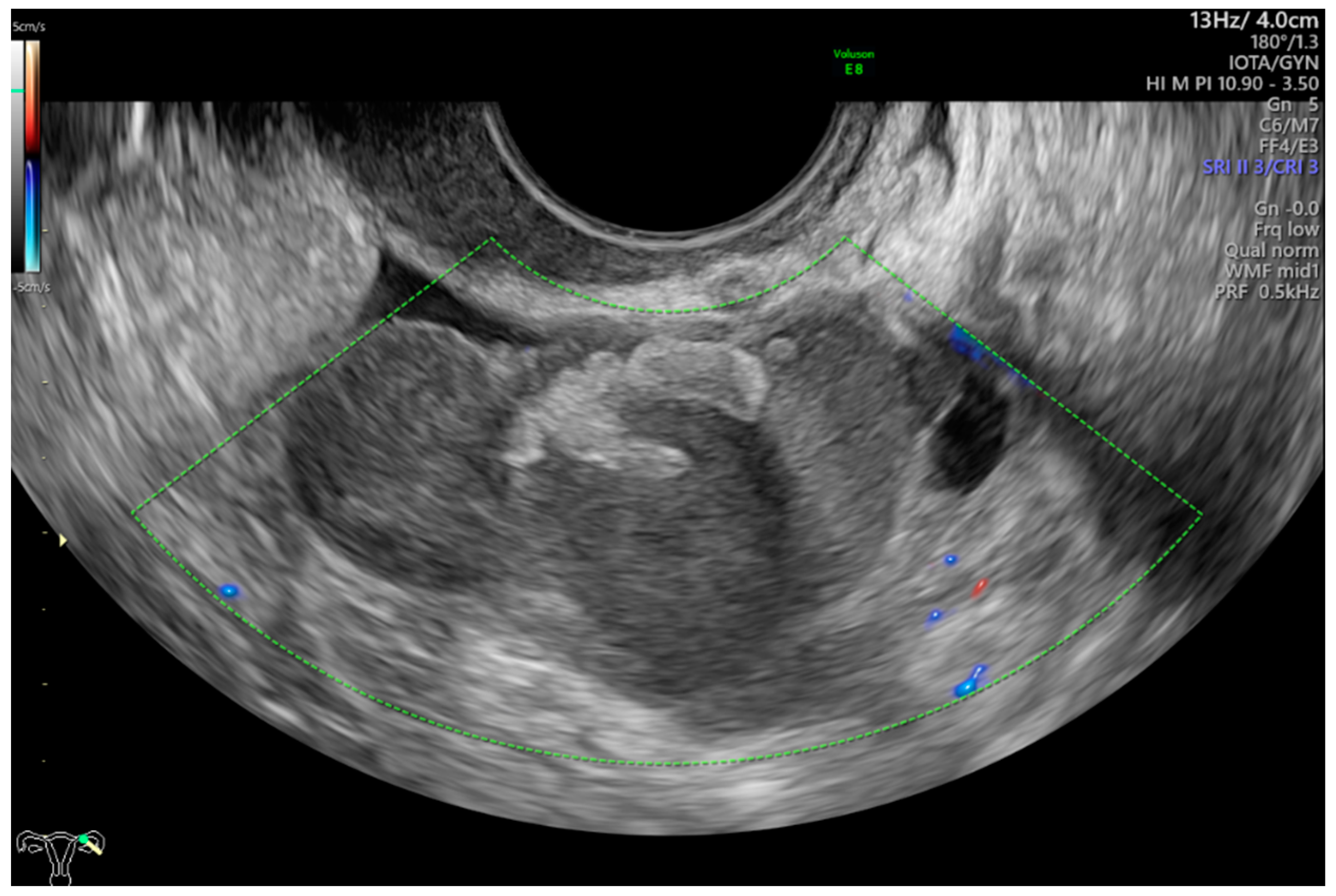 Diagnostics 13 00885 g001