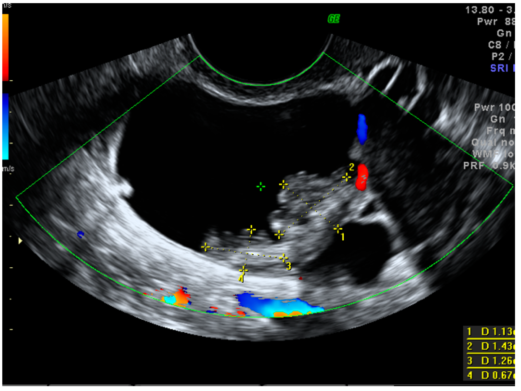Diagnostics 13 00885 g002