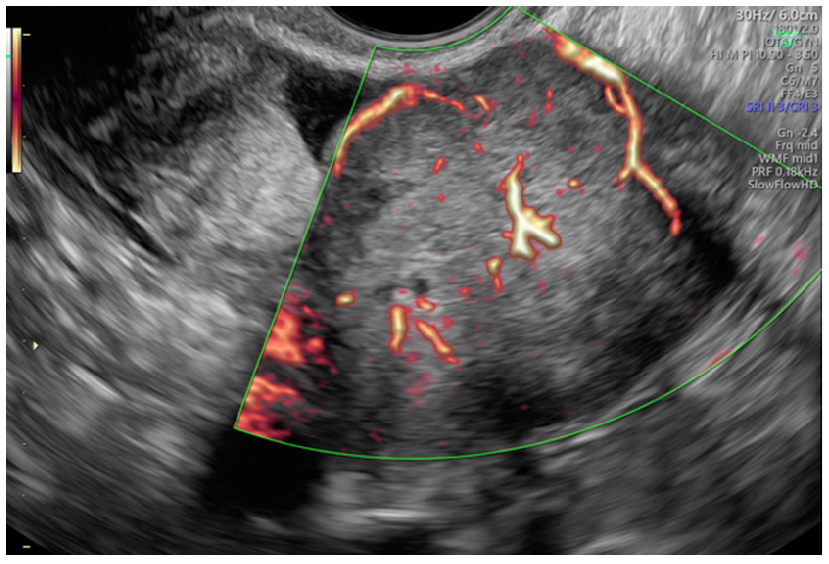 Diagnostics 13 00885 g003