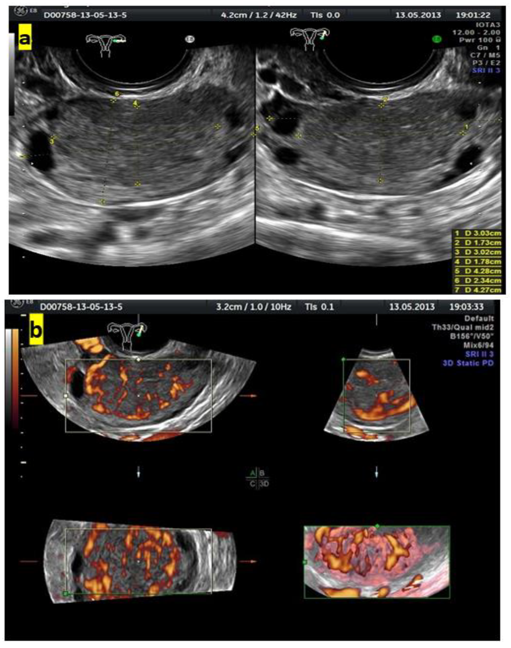 Diagnostics 13 00885 g004