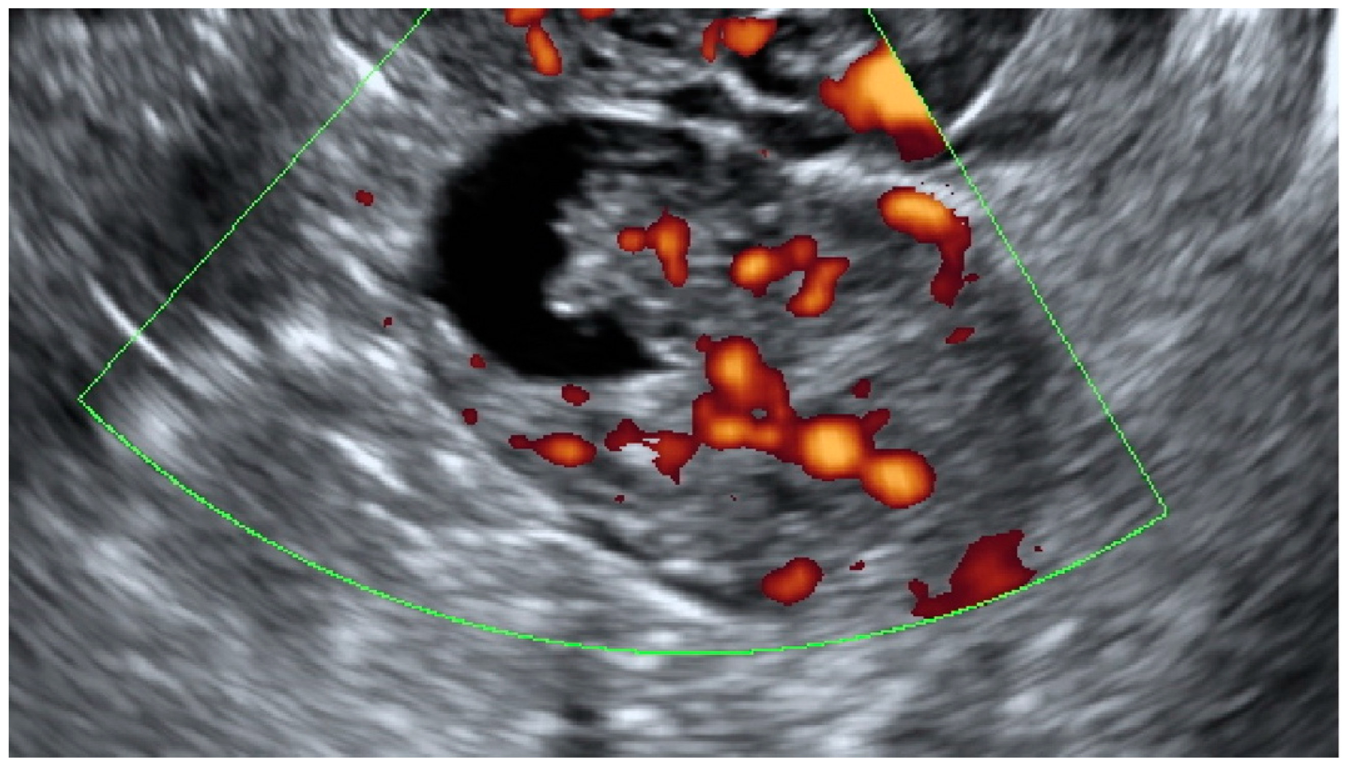 Diagnostics 13 00885 g005