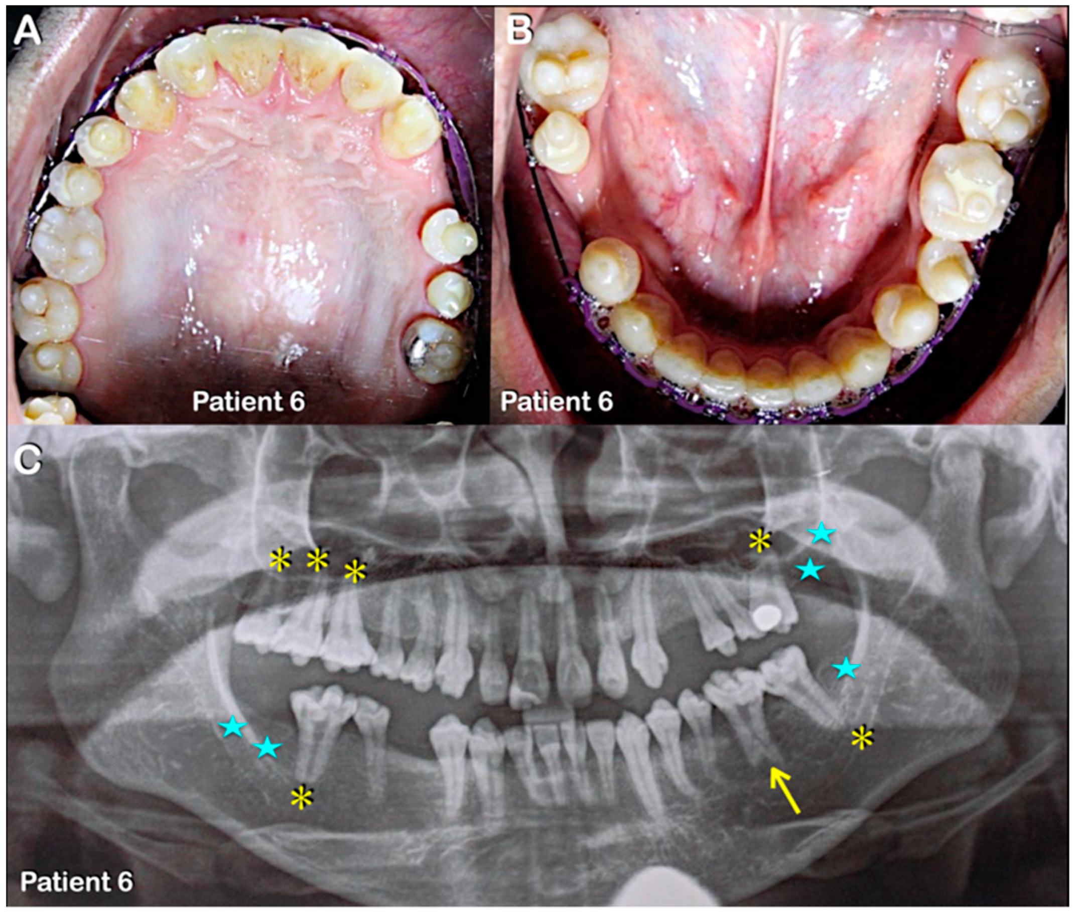 Diagnostics 13 00895 g005 Diagnostics 13 00895 g005