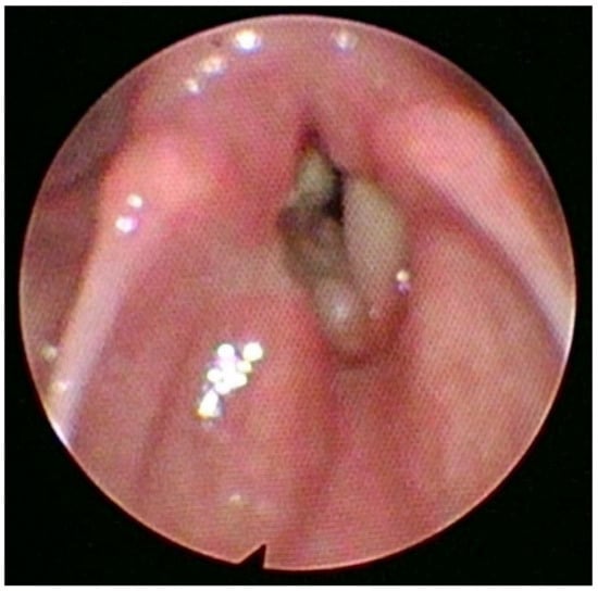 Diagnostics 13 00905 g001