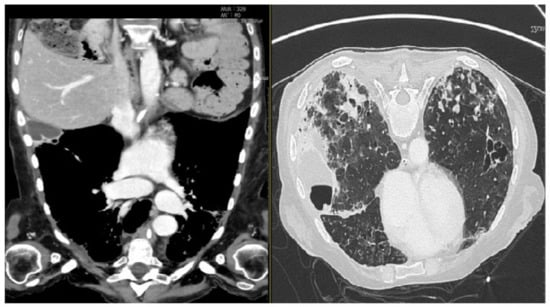 Diagnostics 13 00905 g002