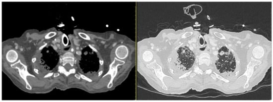 Diagnostics 13 00905 g003