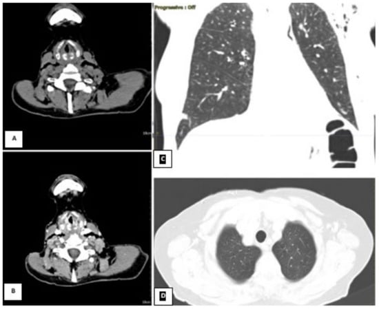 Diagnostics 13 00905 g004
