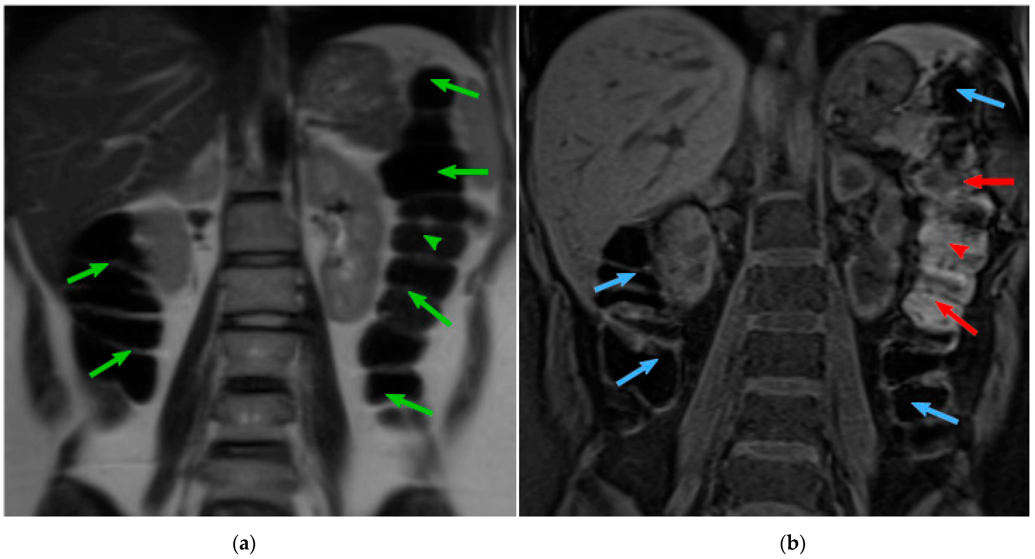 Diagnostics 13 00910 g001 Diagnostics 13 00910 g001
